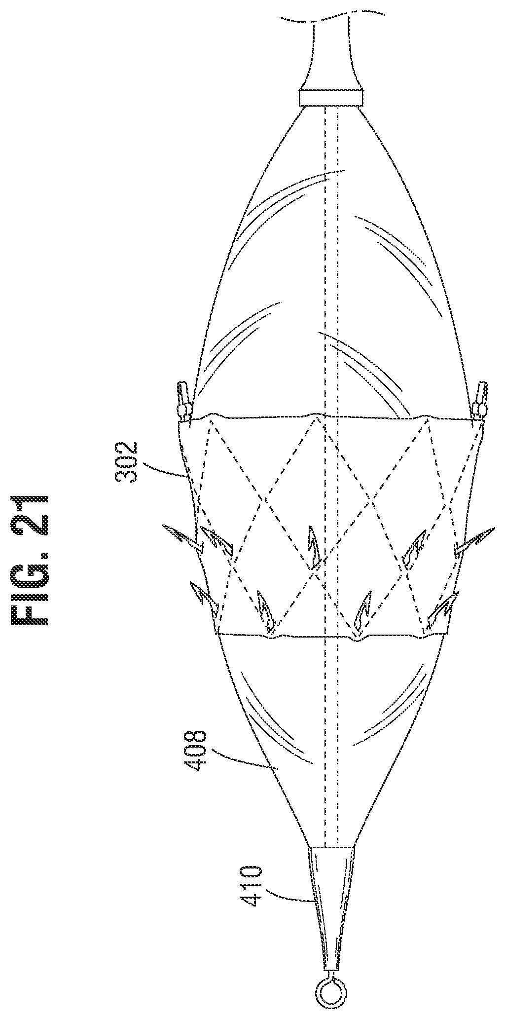 Patent US12599480 Figure 10 – Percutaneous mitral valve replacement device