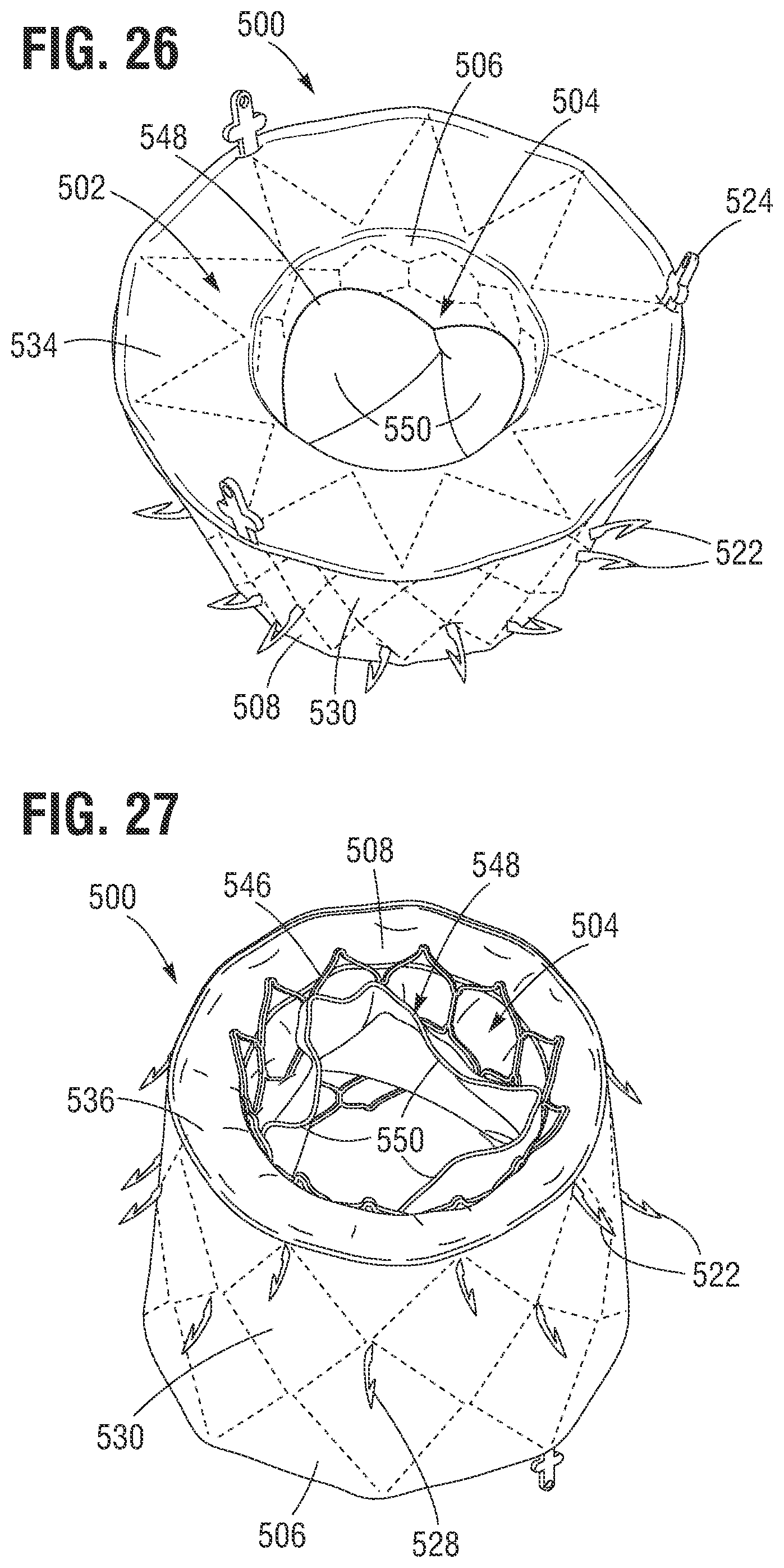 Patent US12599480 Figure 13 – Percutaneous mitral valve replacement device