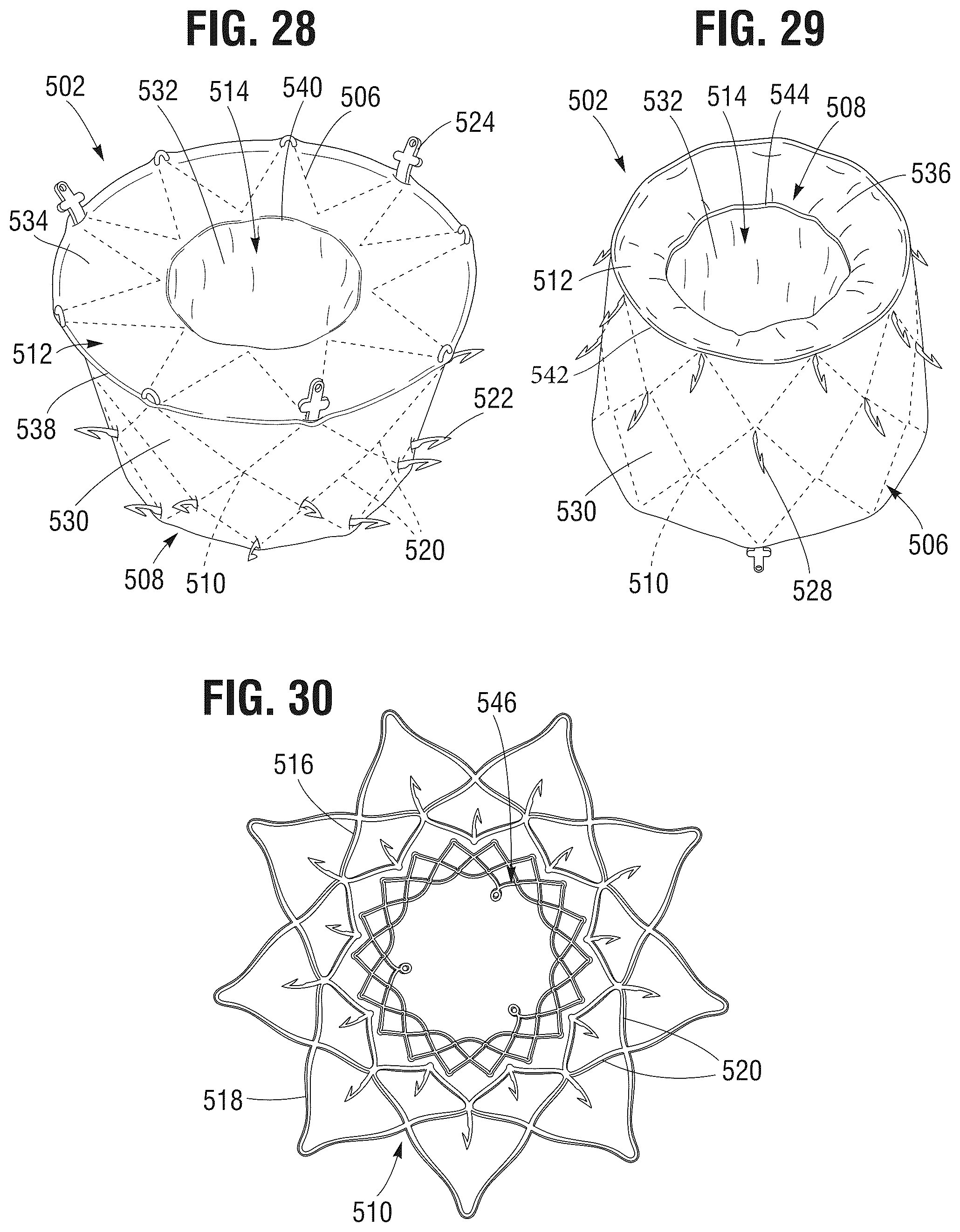 Patent US12599480 Figure 14 – Percutaneous mitral valve replacement device