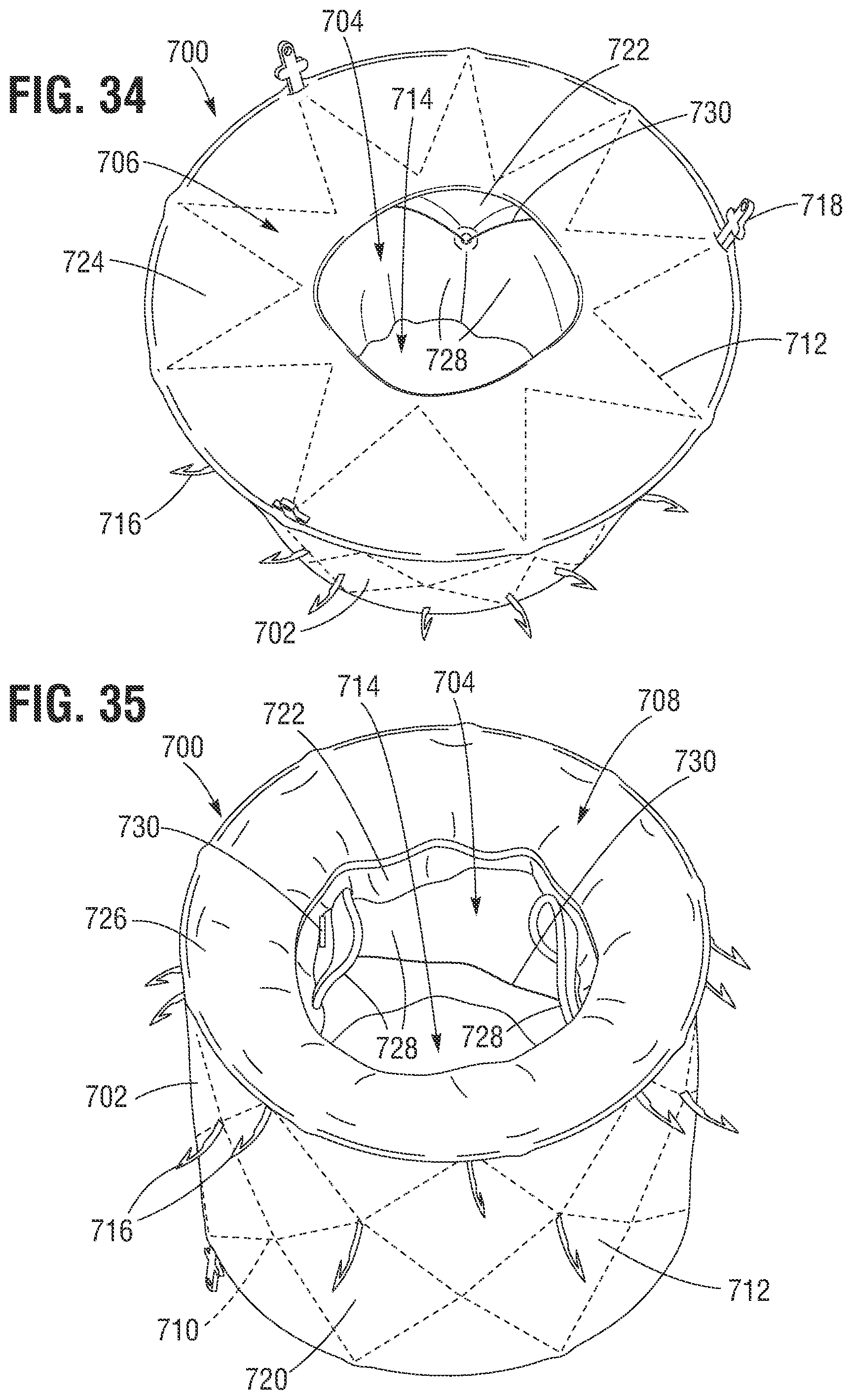 Patent US12599480 Figure 16 – Percutaneous mitral valve replacement device
