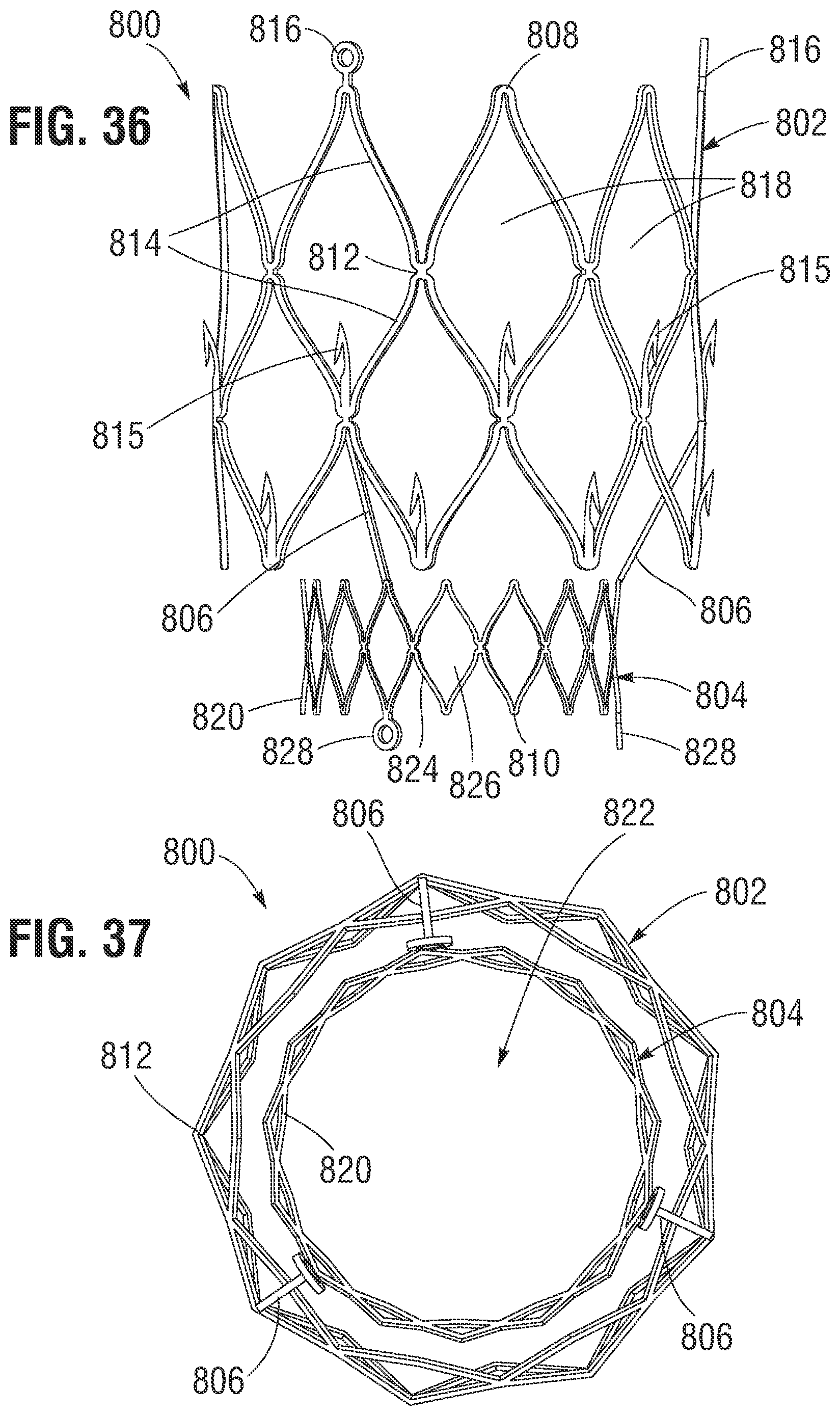 Patent US12599480 Figure 17 – Percutaneous mitral valve replacement device