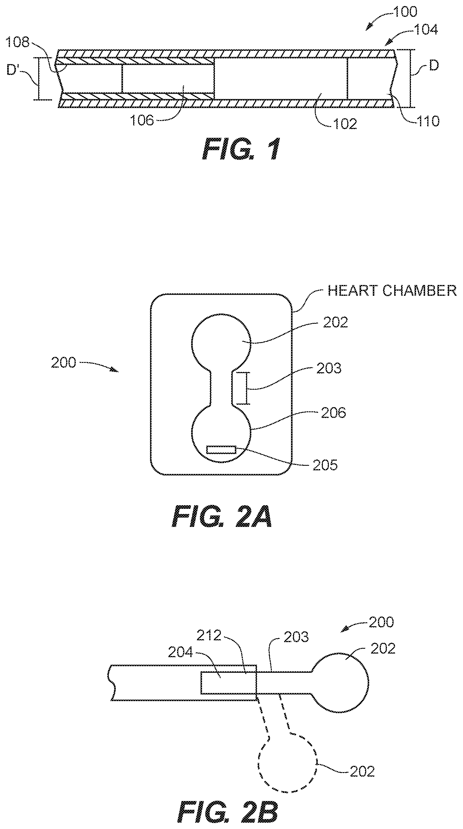 Patent US12599481 Figure 1 – Systems, methods and devices for delivery systems, methods and devices for implanting prosthetic heart valves