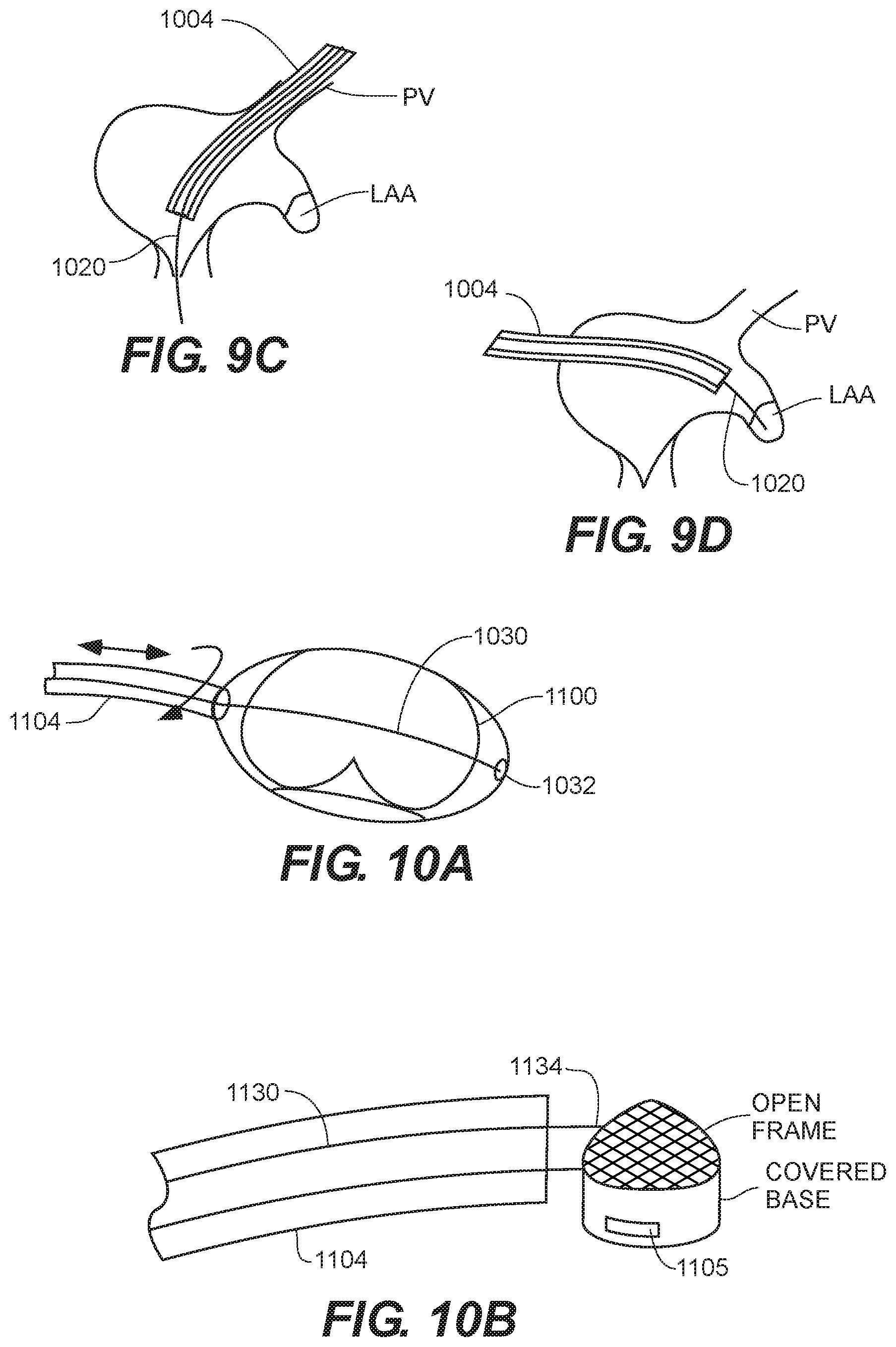 Patent US12599481 Figure 8 – Systems, methods and devices for delivery systems, methods and devices for implanting prosthetic heart valves