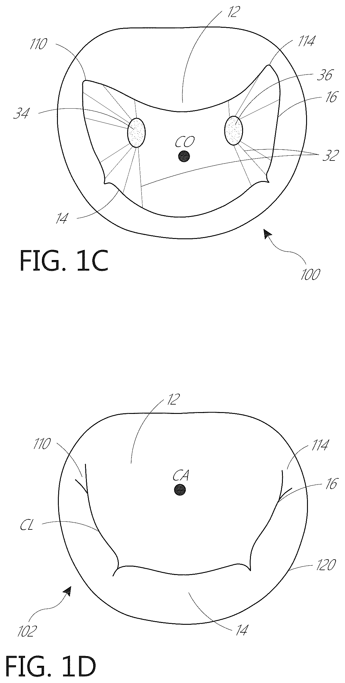 Patent US12599482 Figure 2 – Device, system, and method for transcatheter treatment of valvular regurgitation with secondary anchors