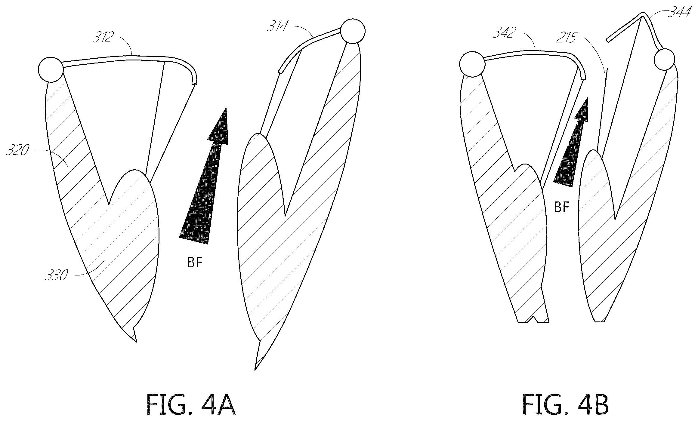 Patent US12599482 Figure 7 – Device, system, and method for transcatheter treatment of valvular regurgitation with secondary anchors