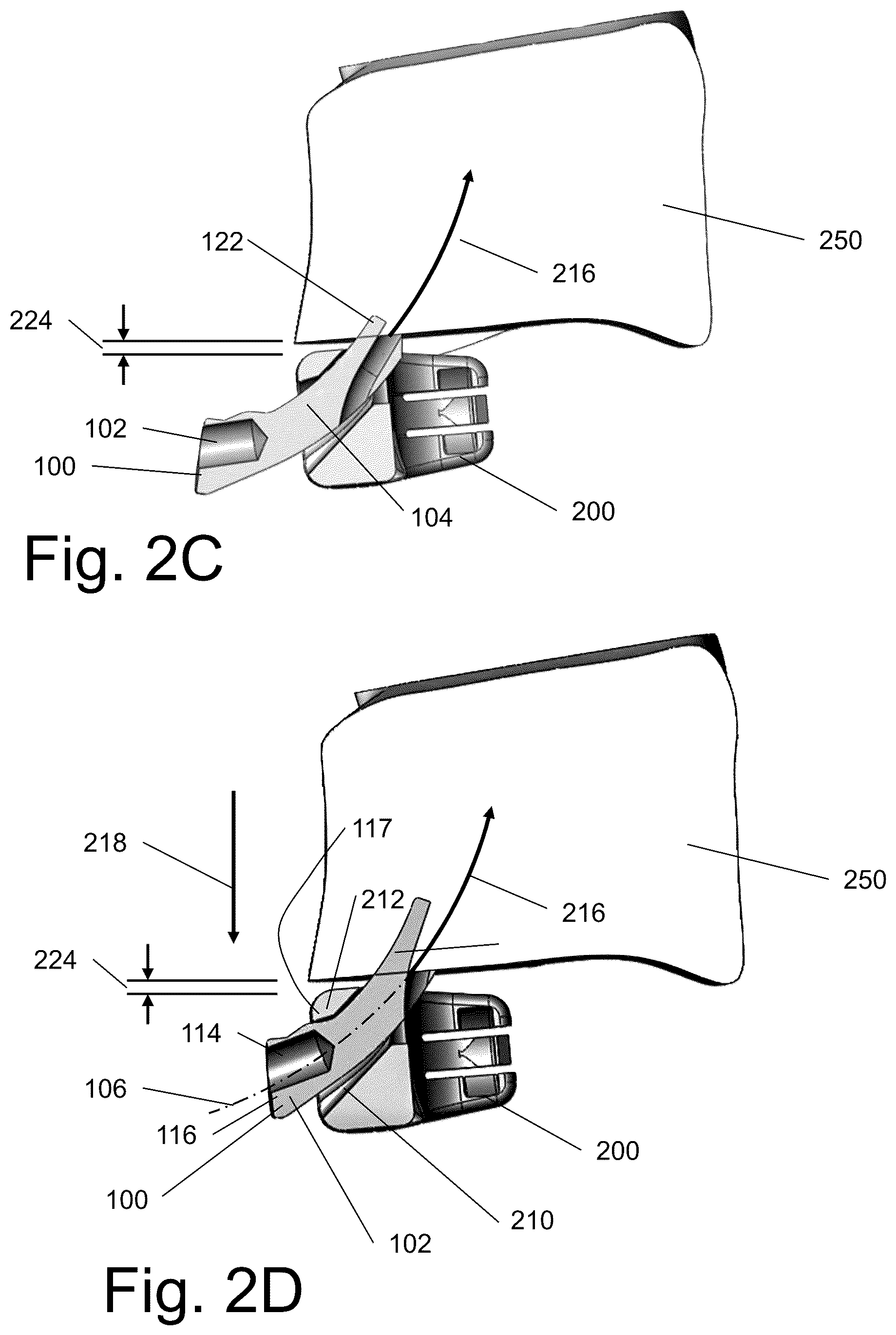 Patent US12599483 Figure 4 – System and method for joining boney structures