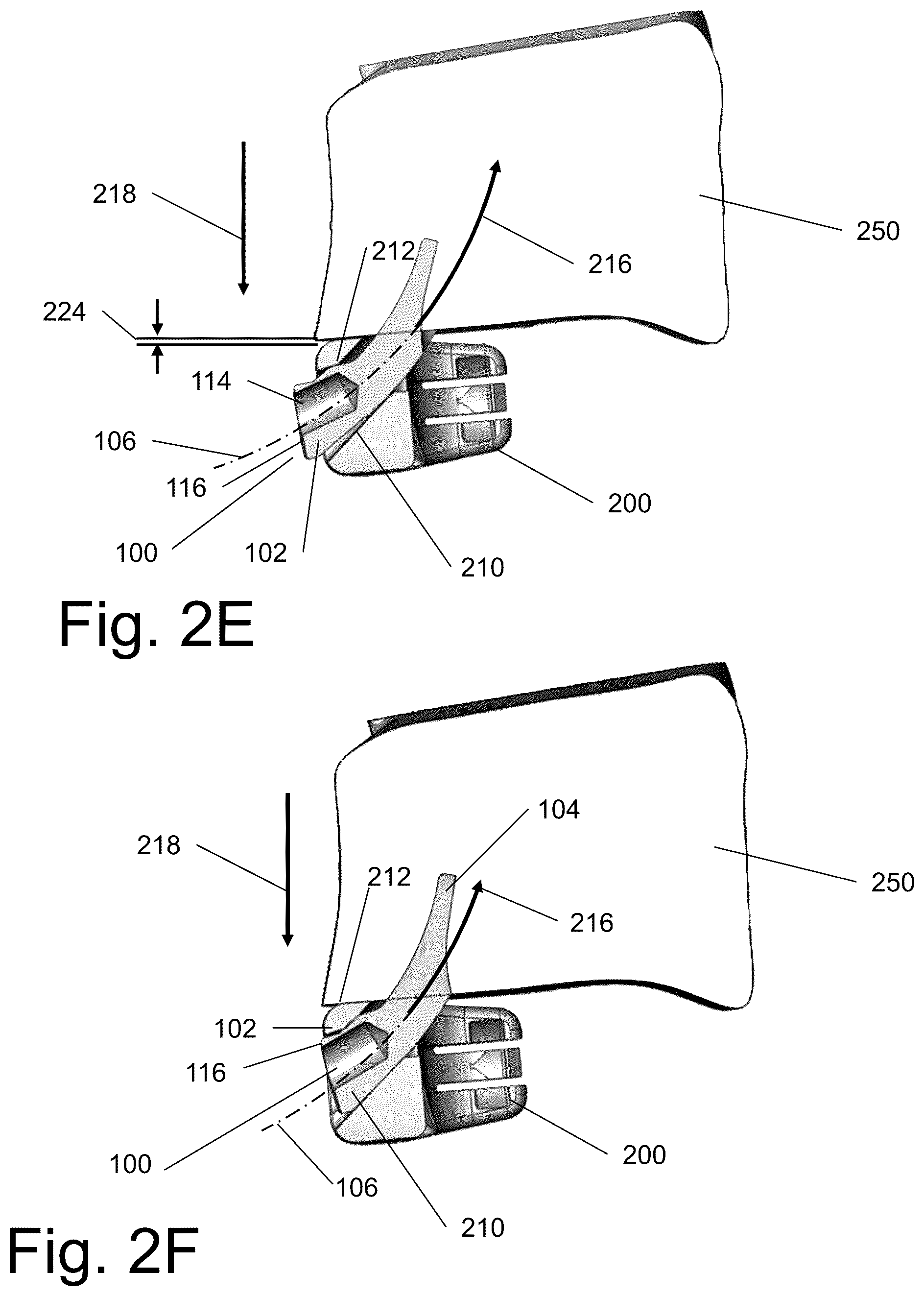 Patent US12599483 Figure 5 – System and method for joining boney structures