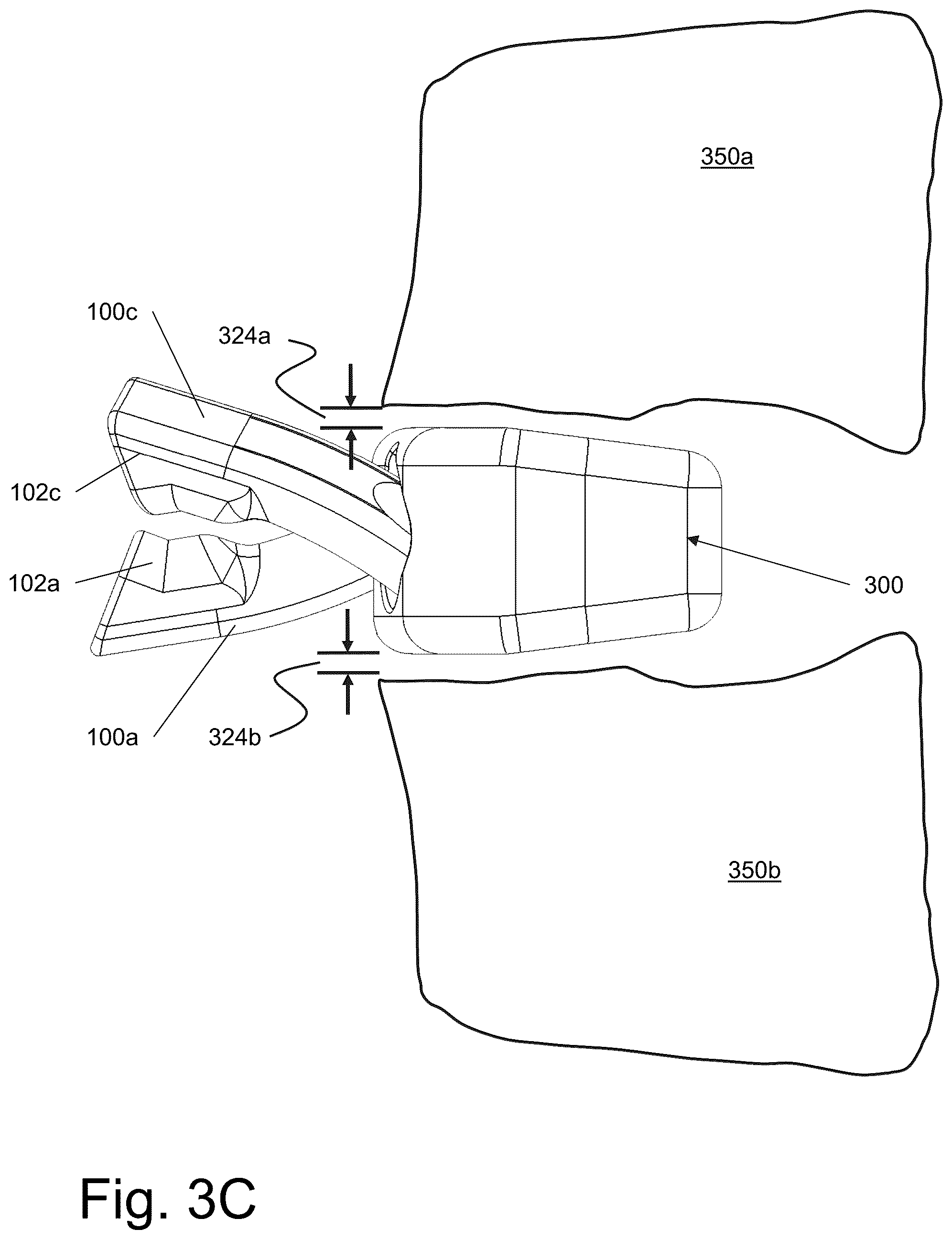 Patent US12599483 Figure 7 – System and method for joining boney structures