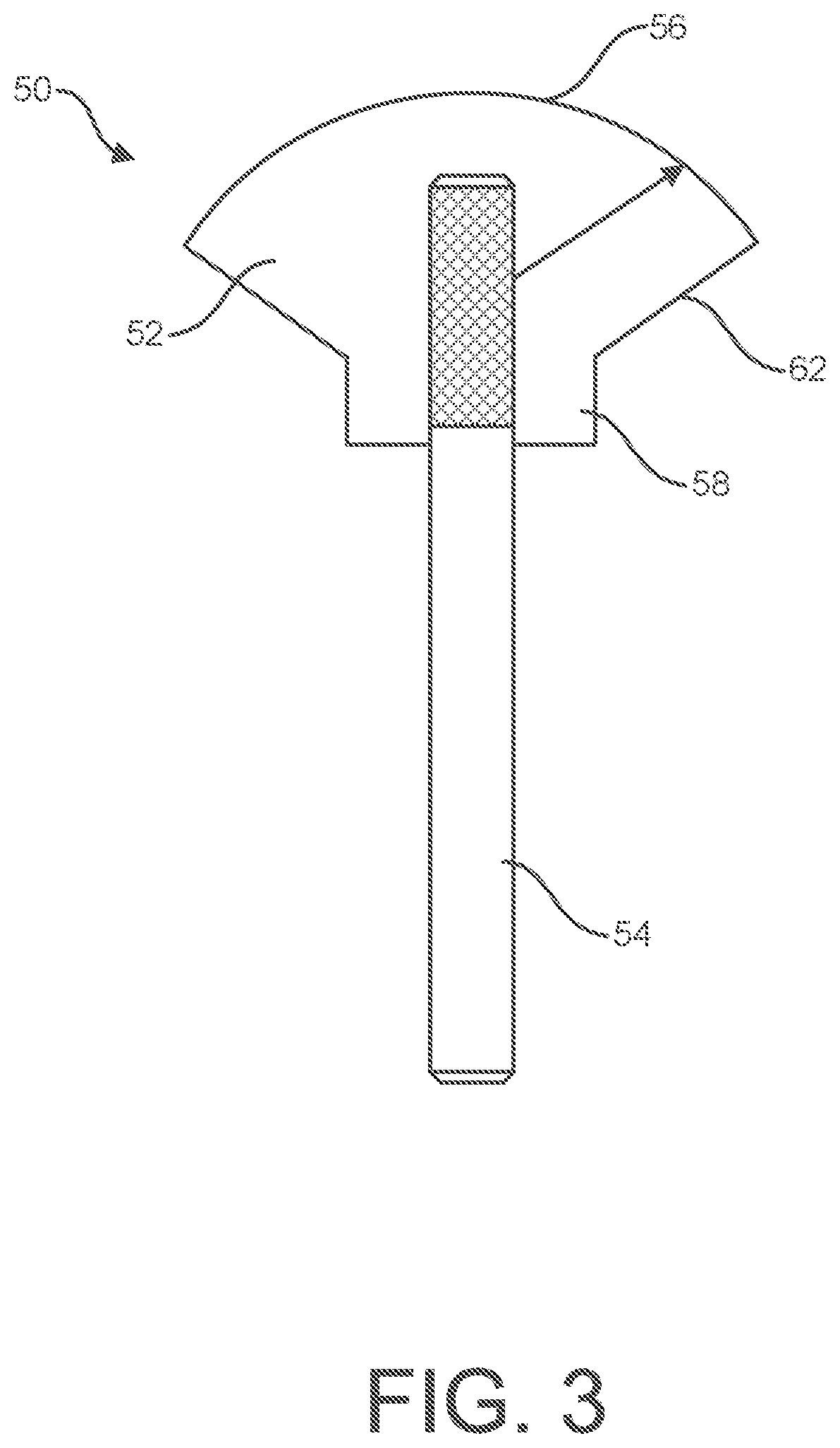 Patent US12599484 Figure 3 – Polishing device for orthopedic devices