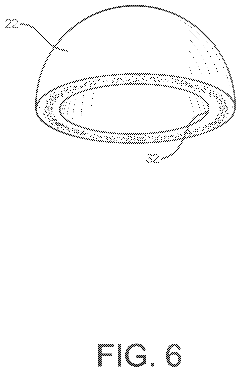 Patent US12599484 Figure 6 – Polishing device for orthopedic devices