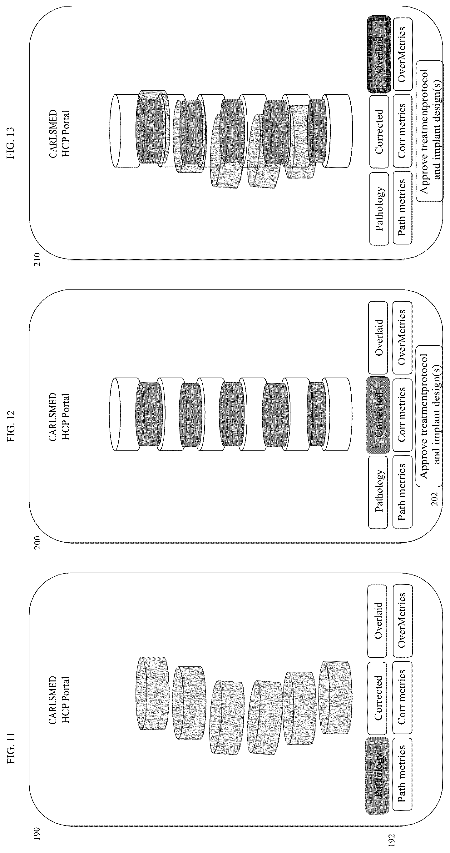 Patent US12599485 Figure 8 – Systems and methods for orthopedic implants