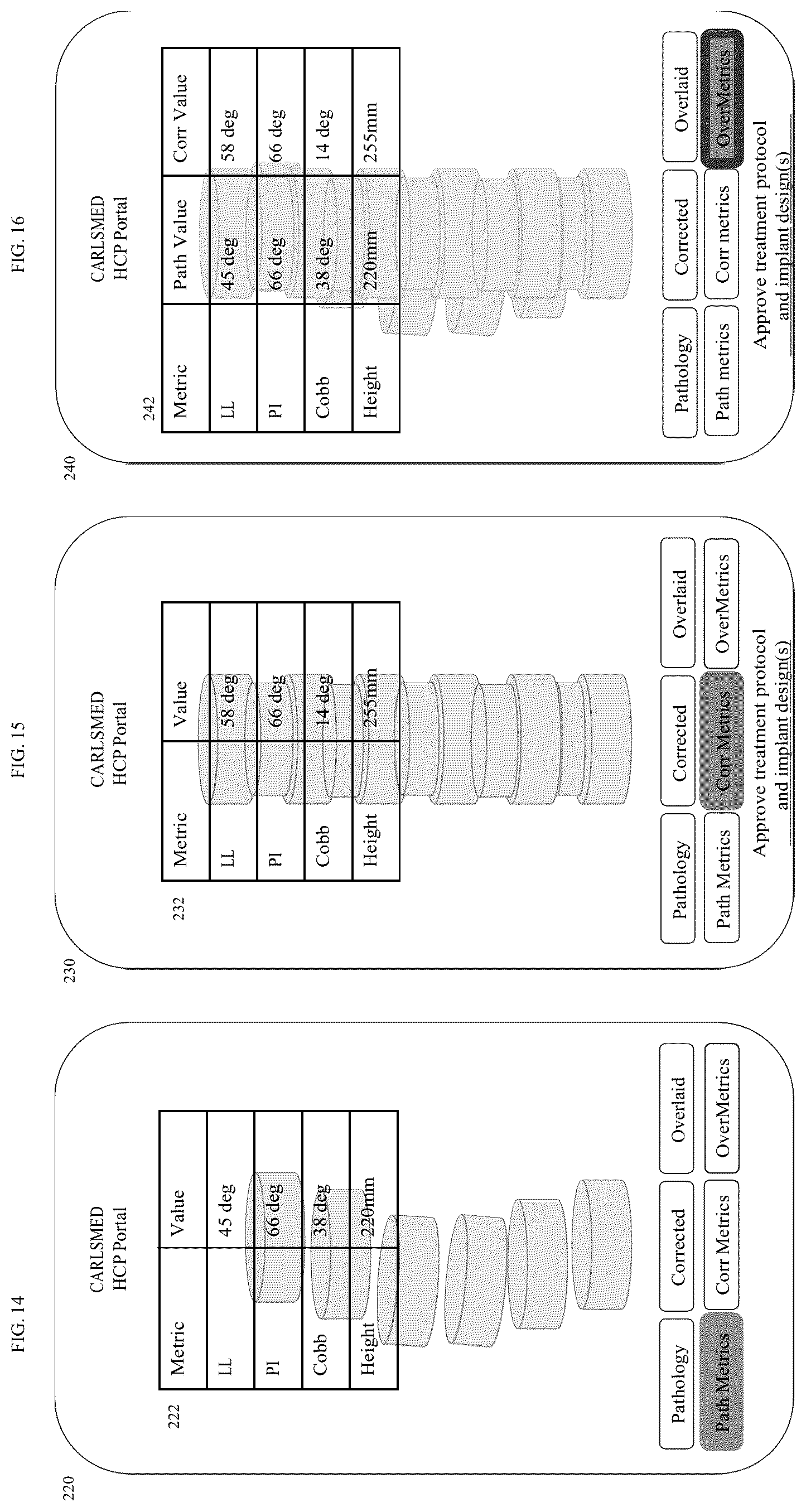 Patent US12599485 Figure 9 – Systems and methods for orthopedic implants