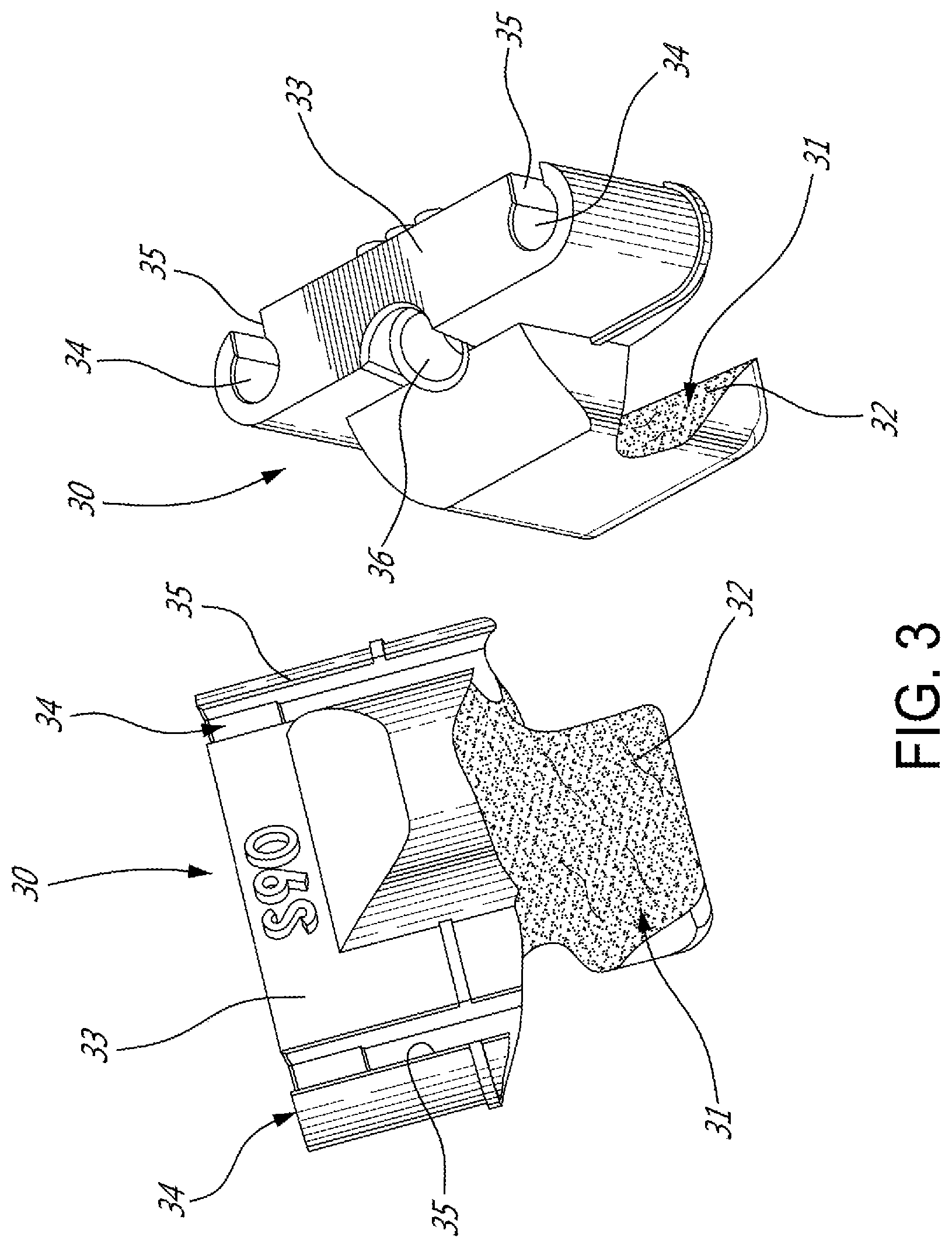 Patent US12599486 Figure 3 – Glenoid implant surgery using patient specific instrumentation