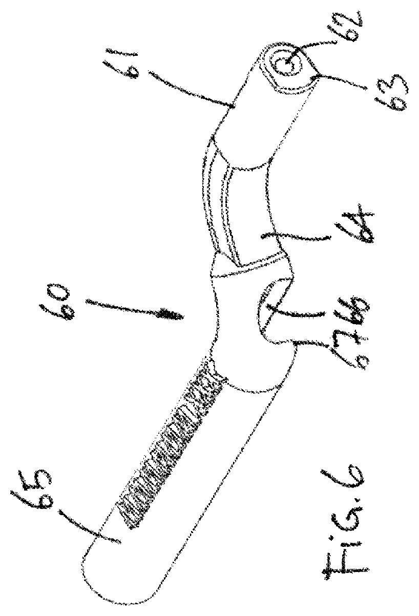 Patent US12599486 Figure 6 – Glenoid implant surgery using patient specific instrumentation