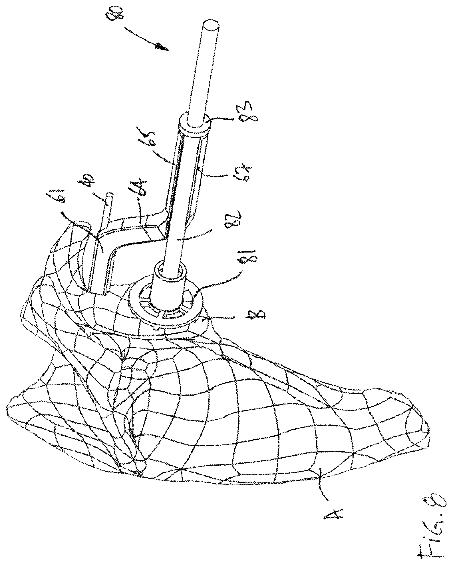 Patent US12599486 Figure 8 – Glenoid implant surgery using patient specific instrumentation