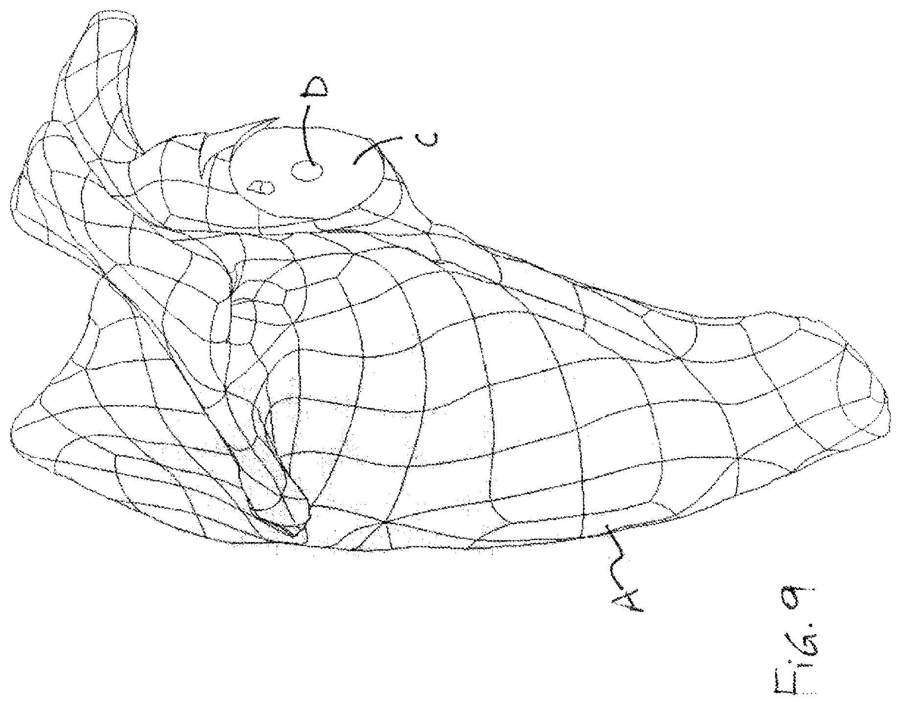 Patent US12599486 Figure 9 – Glenoid implant surgery using patient specific instrumentation