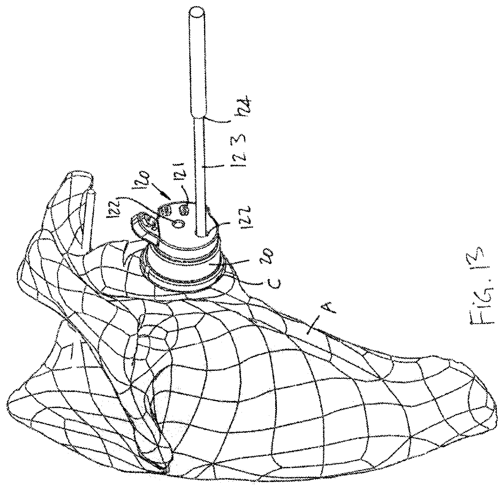 Patent US12599486 Figure 13 – Glenoid implant surgery using patient specific instrumentation