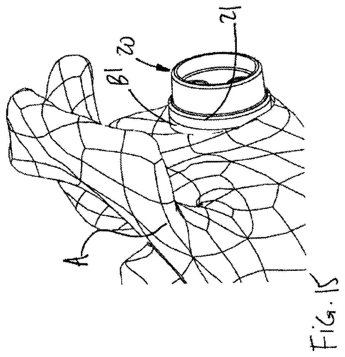 Patent US12599486 Figure 15 – Glenoid implant surgery using patient specific instrumentation