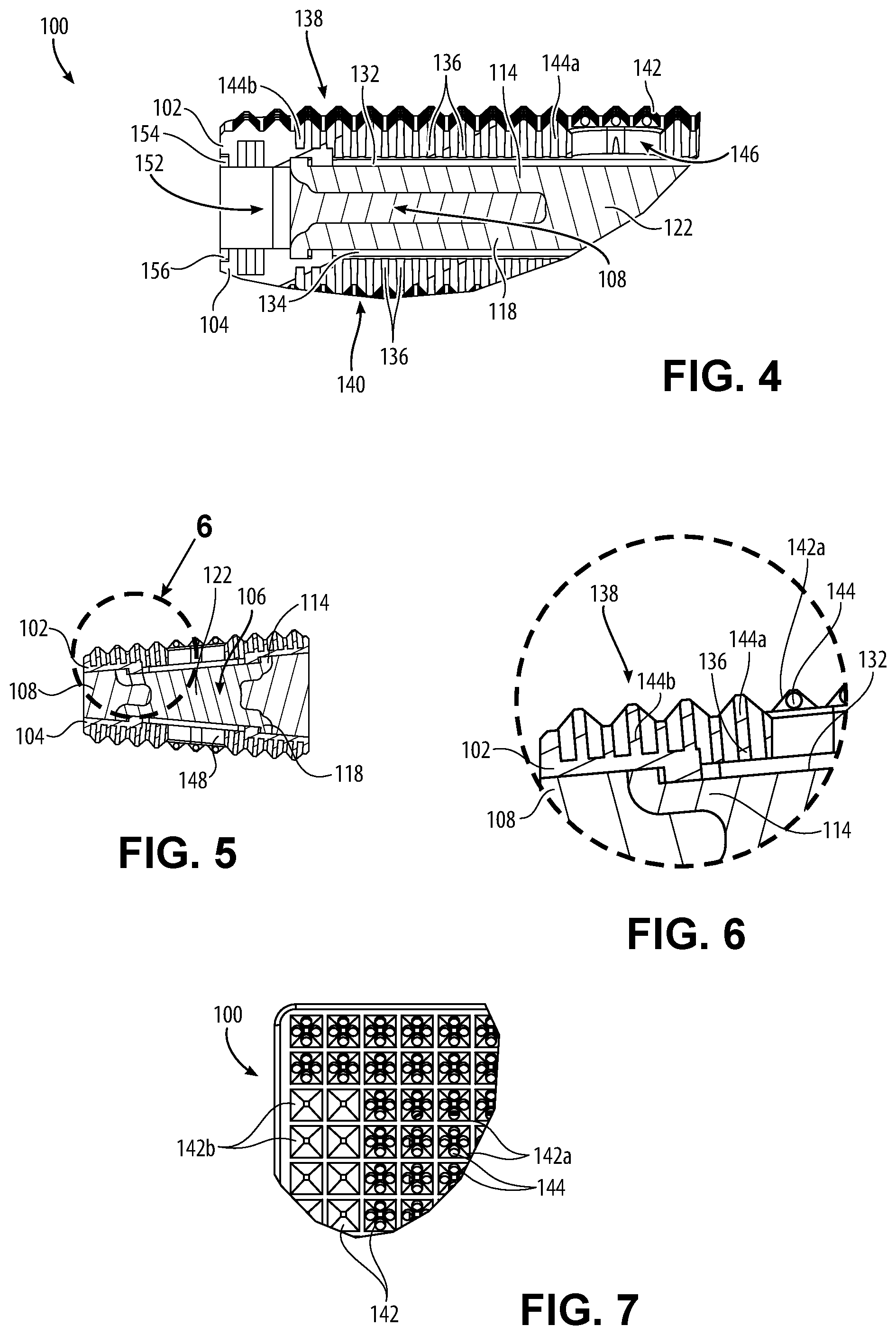 Patent US12599487 Figure 3 – Tools and implants for lateral disc replacement