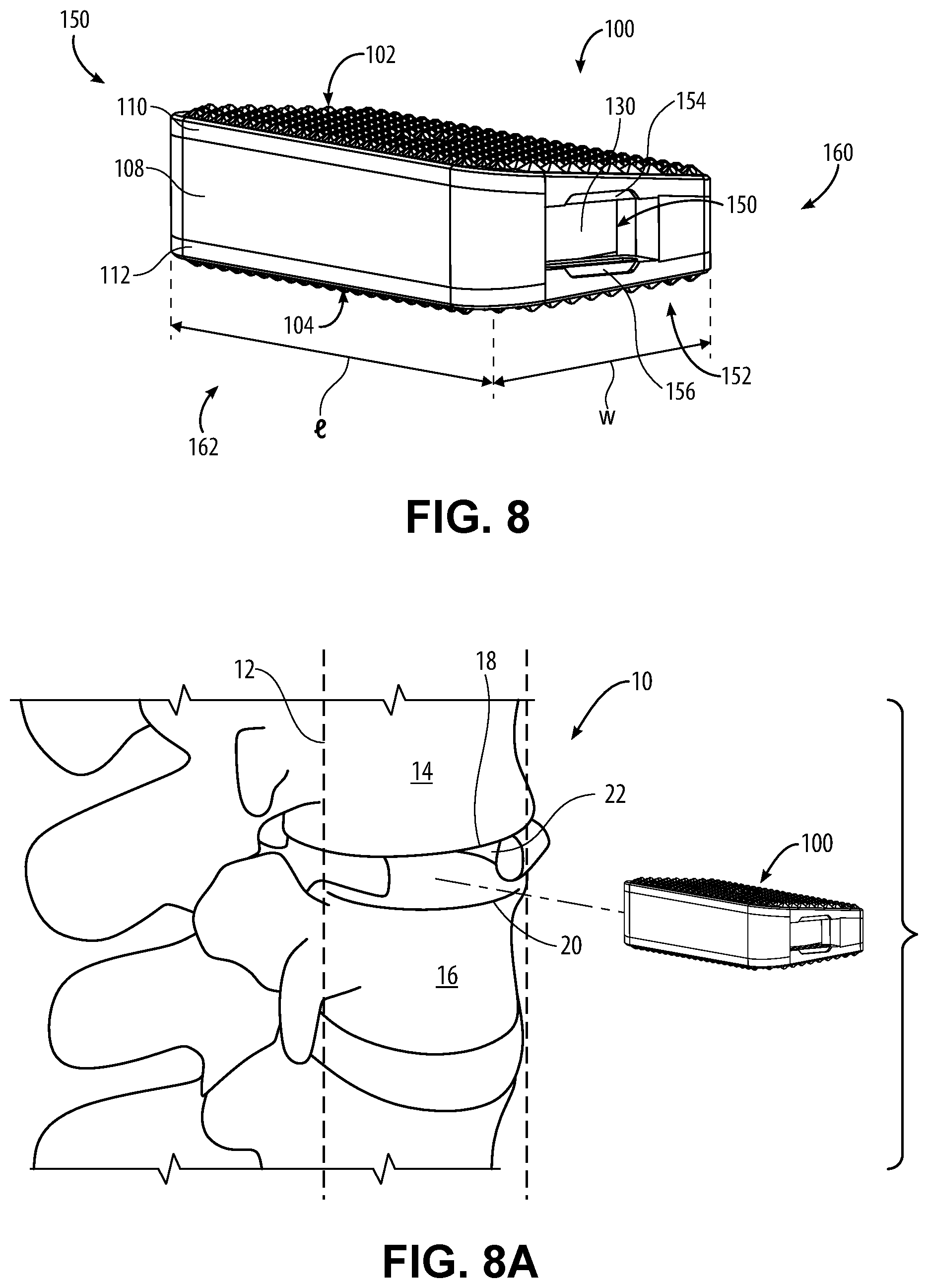 Patent US12599487 Figure 4 – Tools and implants for lateral disc replacement