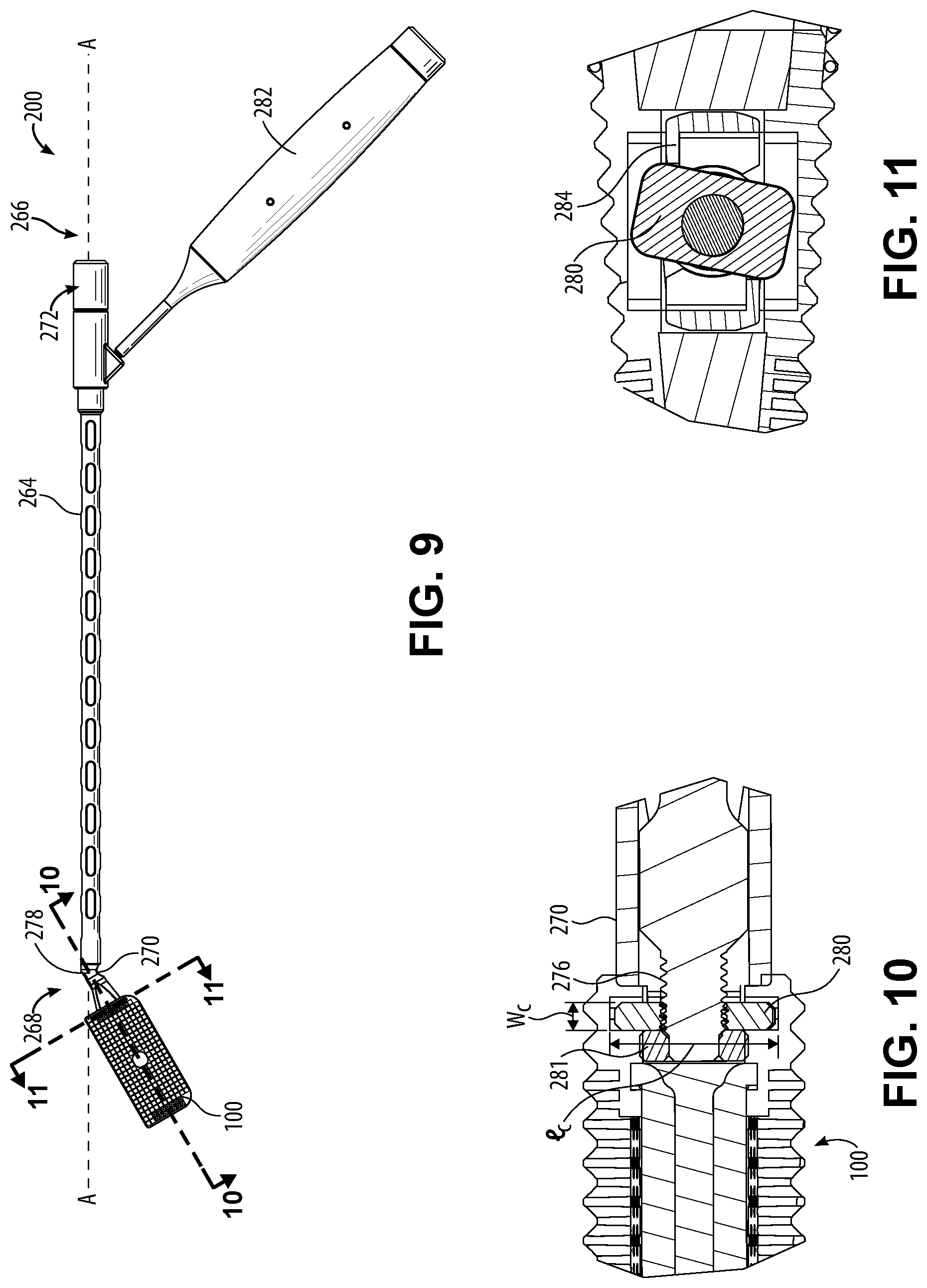Patent US12599487 Figure 5 – Tools and implants for lateral disc replacement