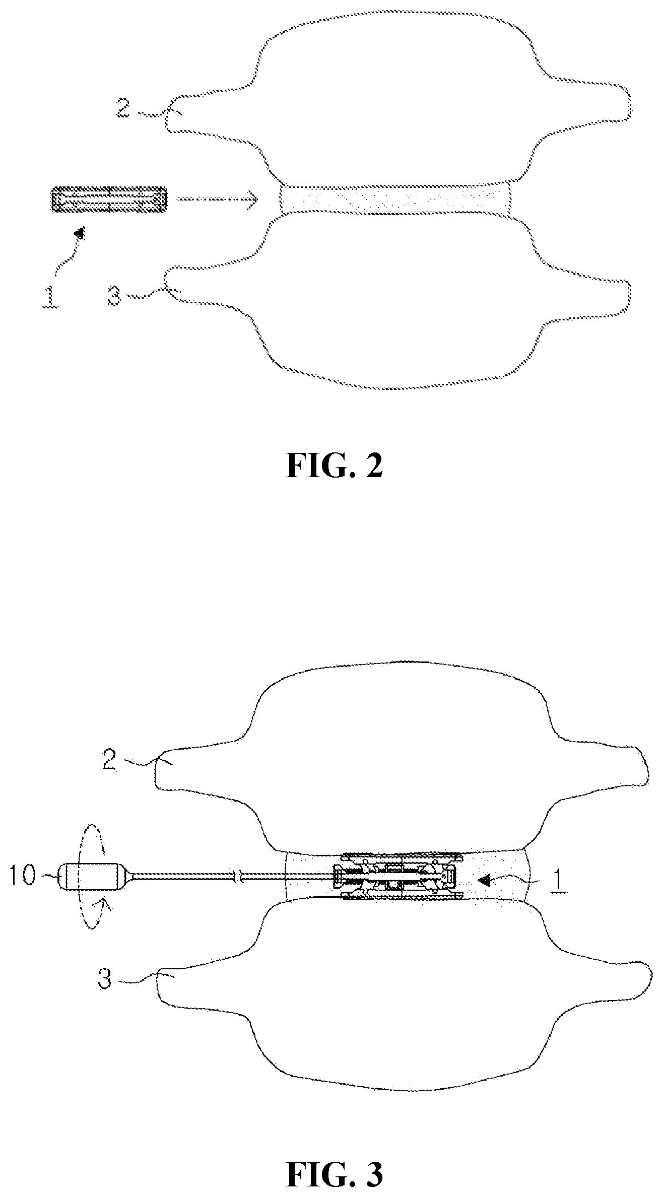 Patent US12599488 Figure 2 – Bi-planar expandable cage for spine