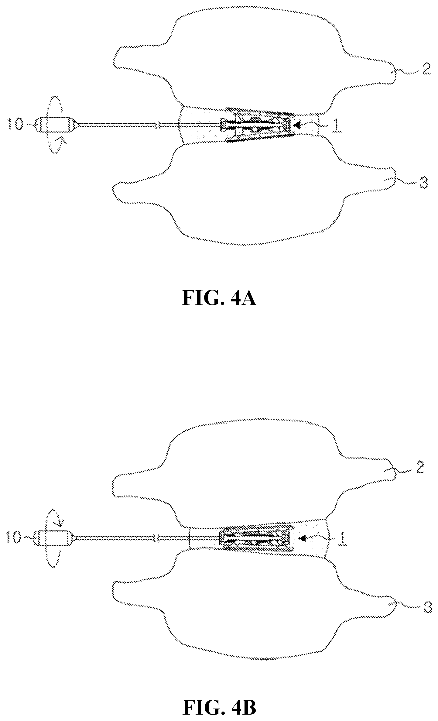 Patent US12599488 Figure 3 – Bi-planar expandable cage for spine