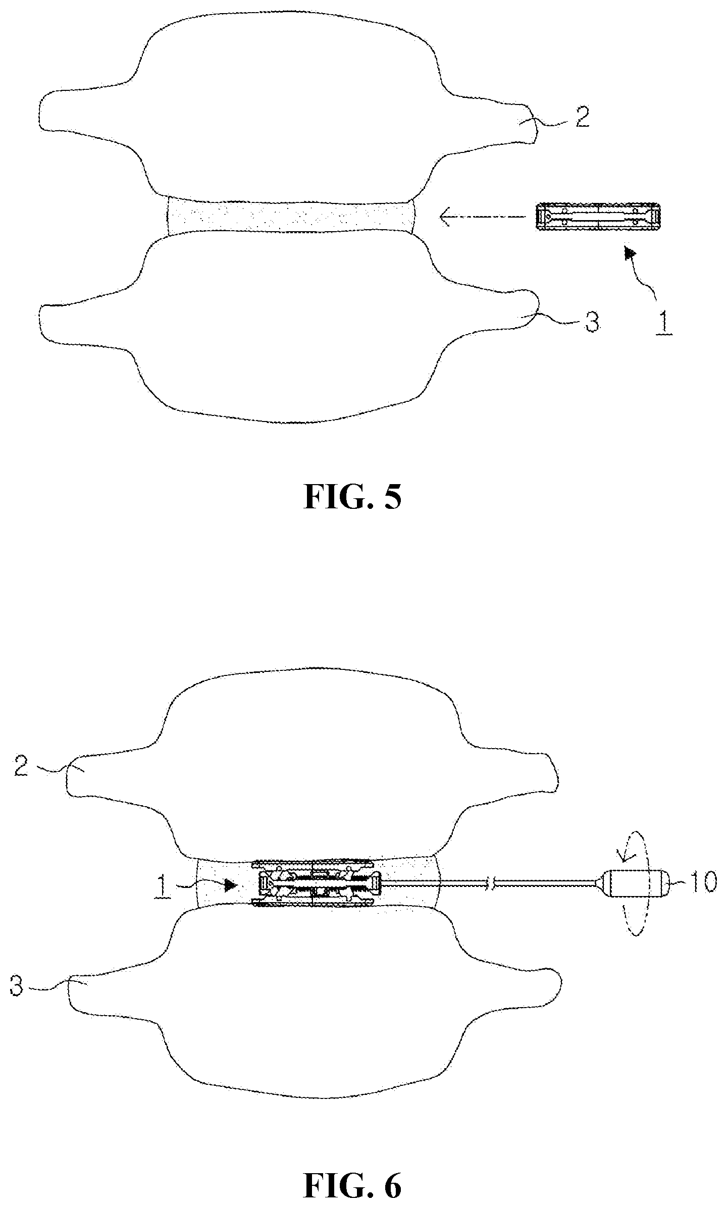 Patent US12599488 Figure 4 – Bi-planar expandable cage for spine