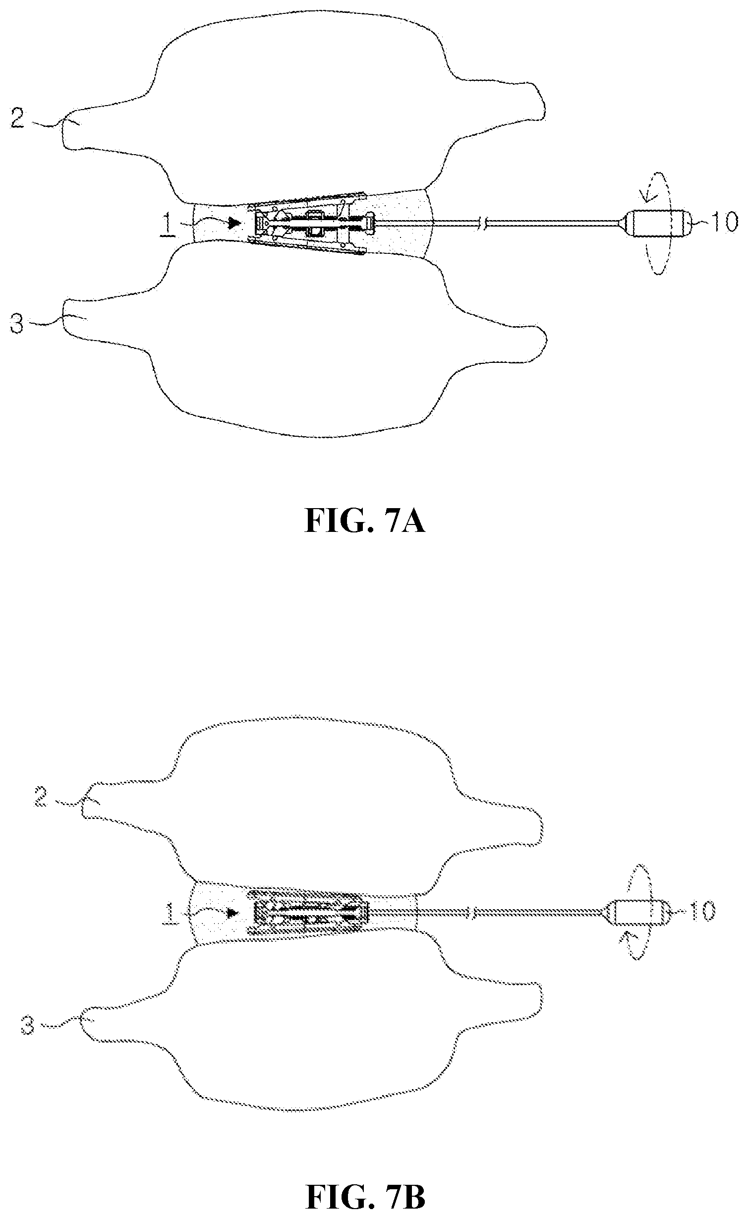 Patent US12599488 Figure 5 – Bi-planar expandable cage for spine