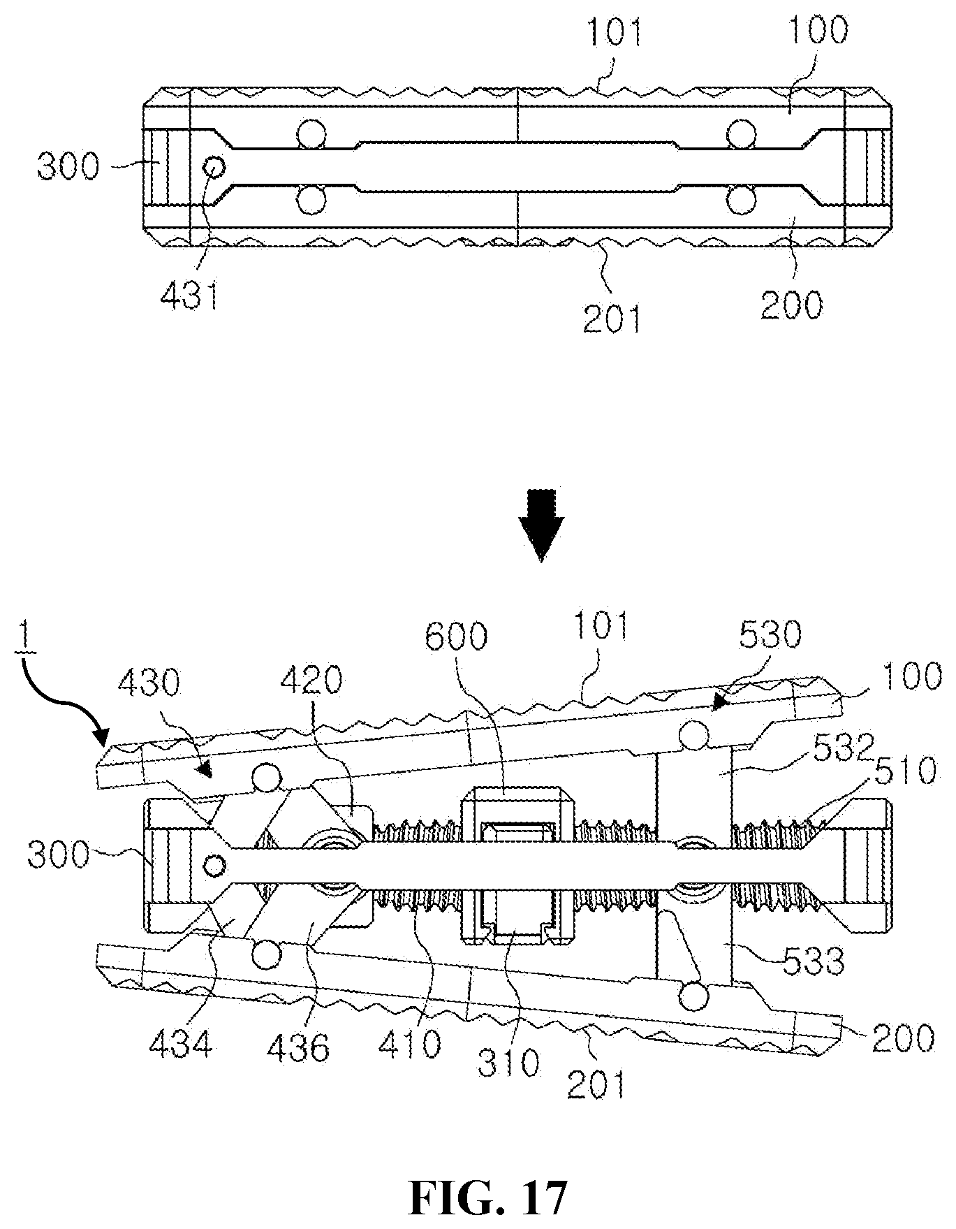 Patent US12599488 Figure 12 – Bi-planar expandable cage for spine
