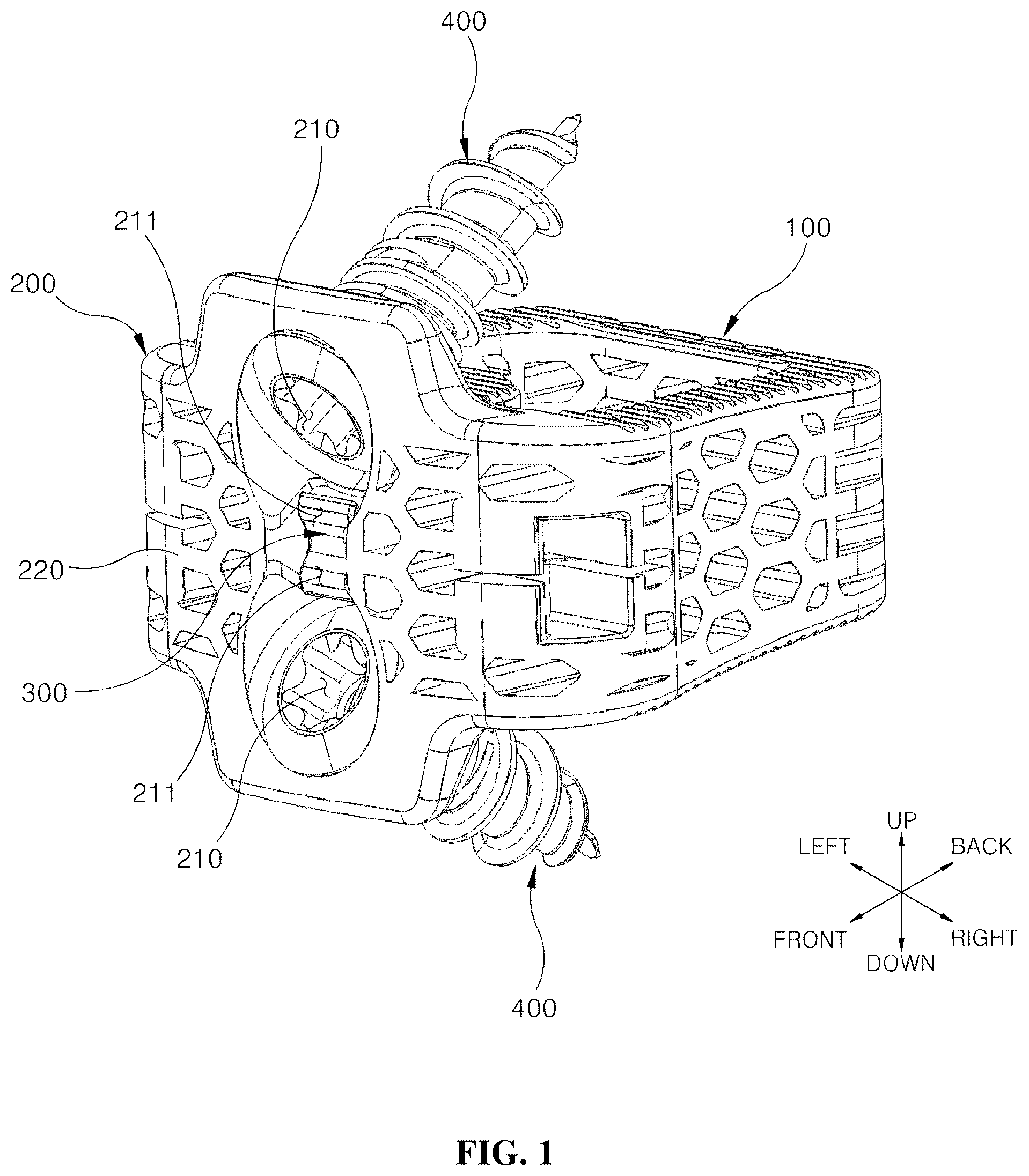 Patent US12599489 Figure 1 – Spinal cage fixable through insertion of bone screws
