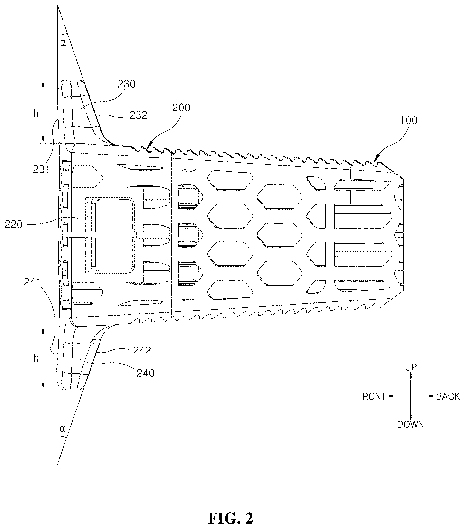 Patent US12599489 Figure 2 – Spinal cage fixable through insertion of bone screws