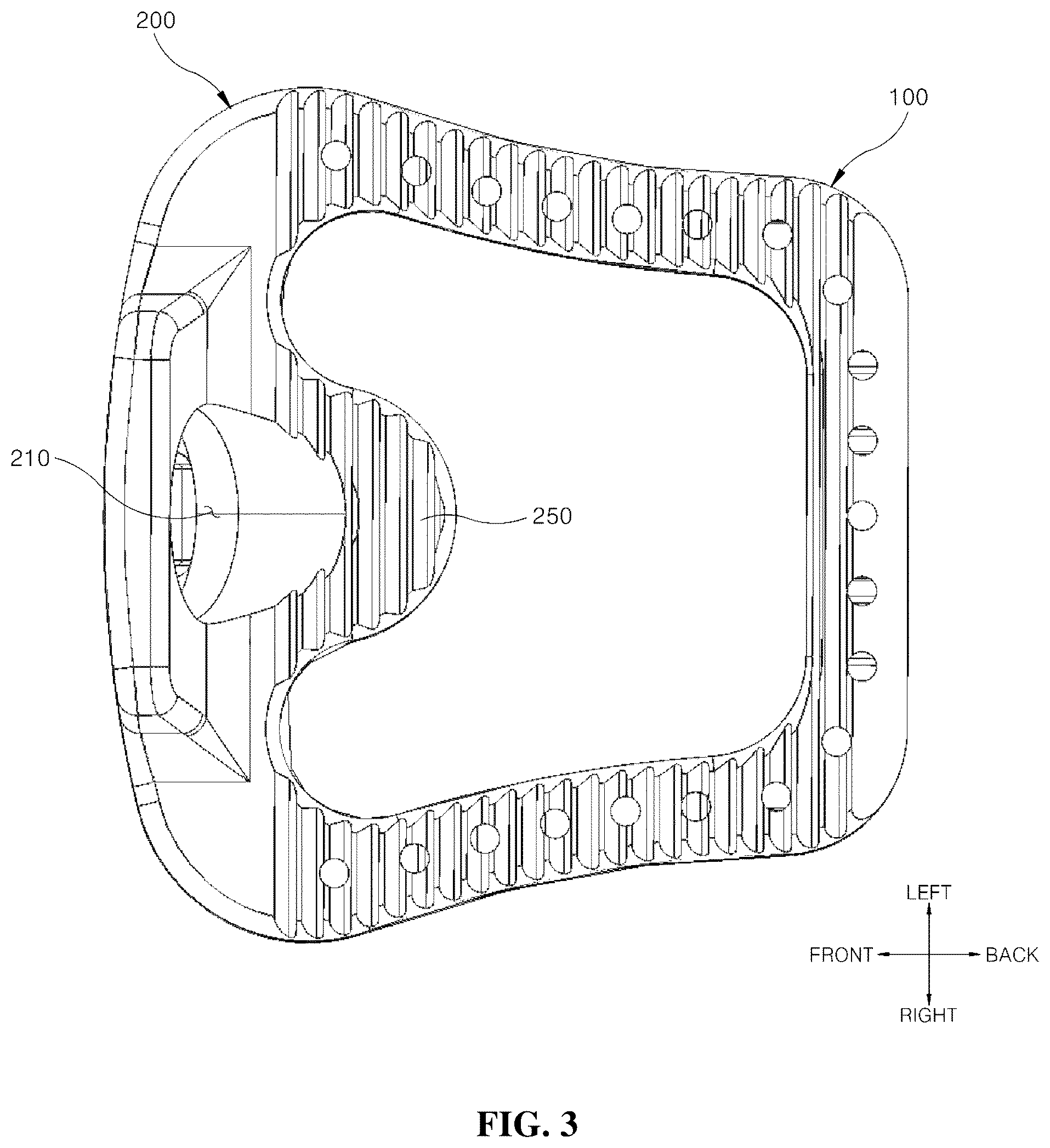 Patent US12599489 Figure 3 – Spinal cage fixable through insertion of bone screws