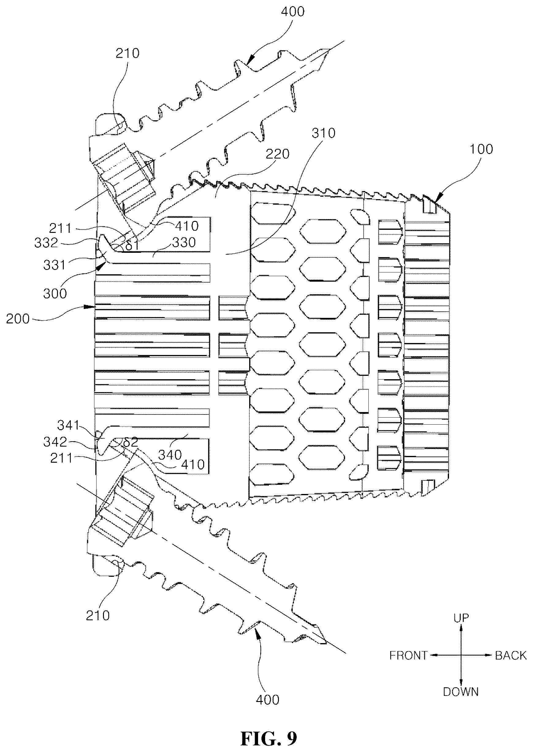 Patent US12599489 Figure 9 – Spinal cage fixable through insertion of bone screws
