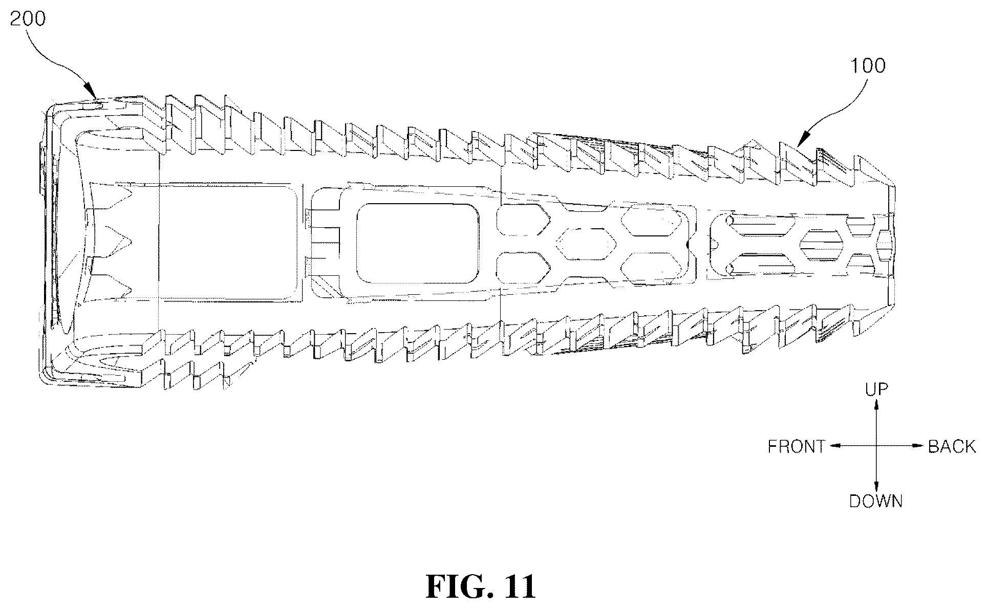 Patent US12599489 Figure 11 – Spinal cage fixable through insertion of bone screws