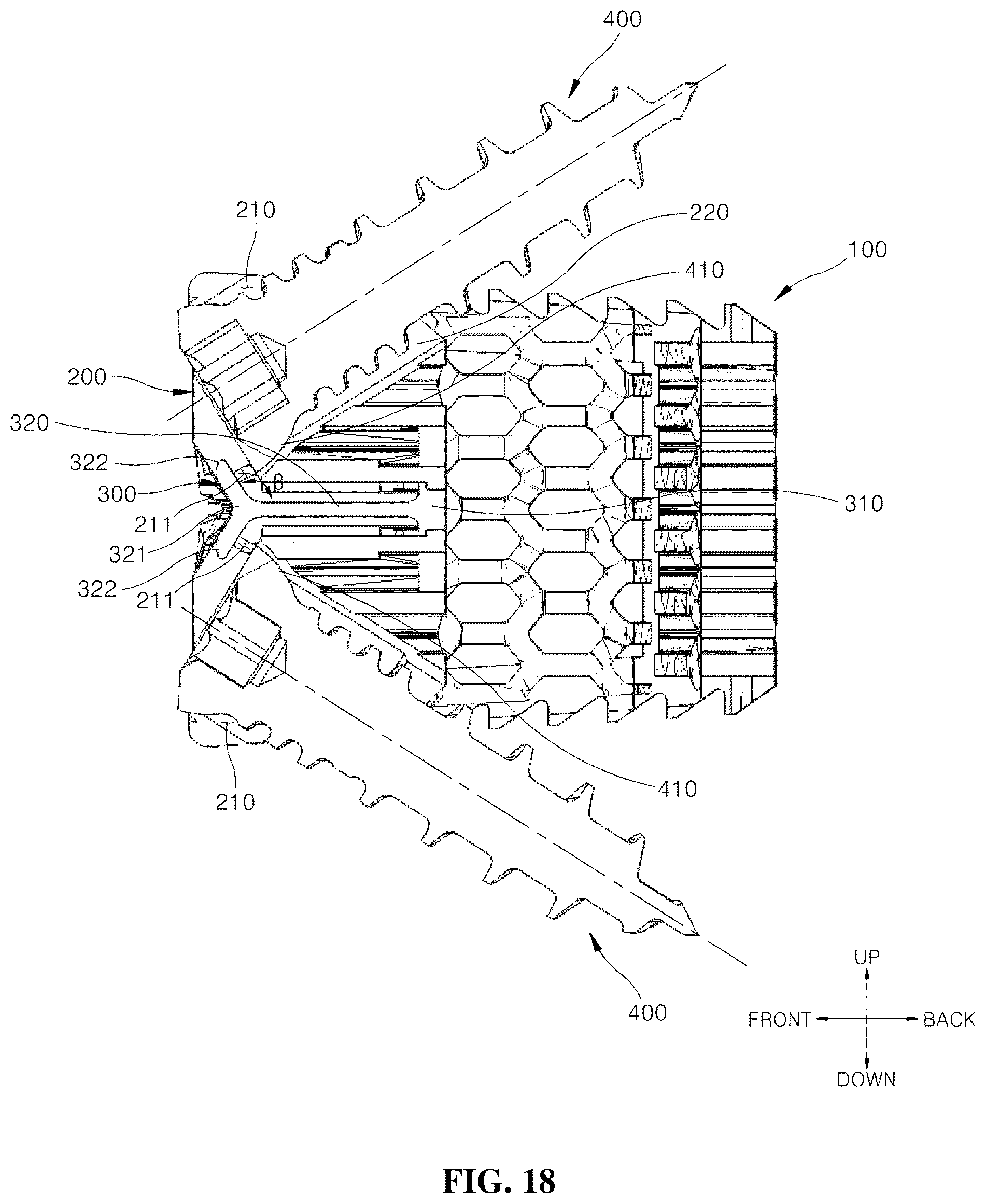 Patent US12599489 Figure 18 – Spinal cage fixable through insertion of bone screws