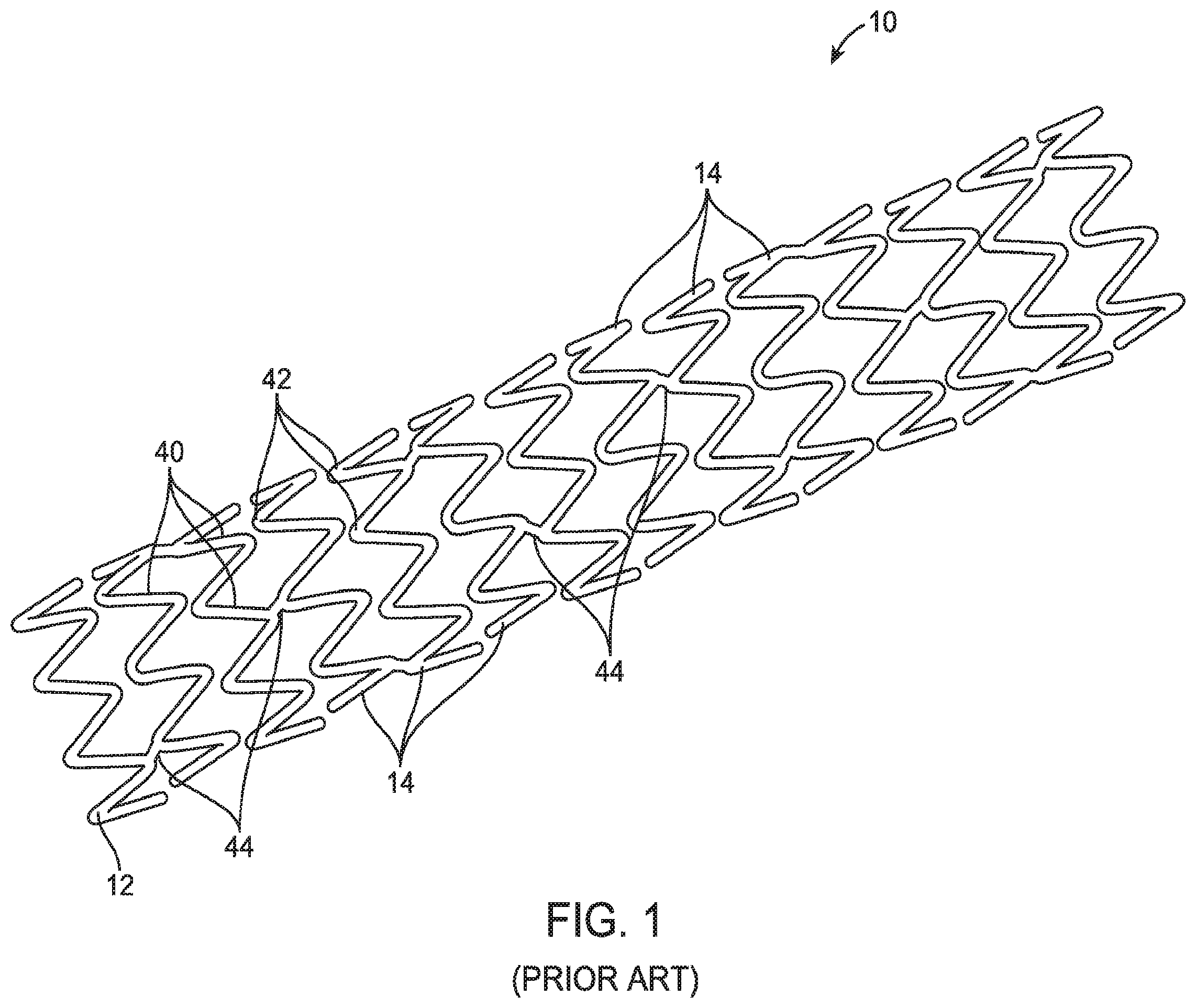 Patent US12599490 Figure 1 – Uncaging stent