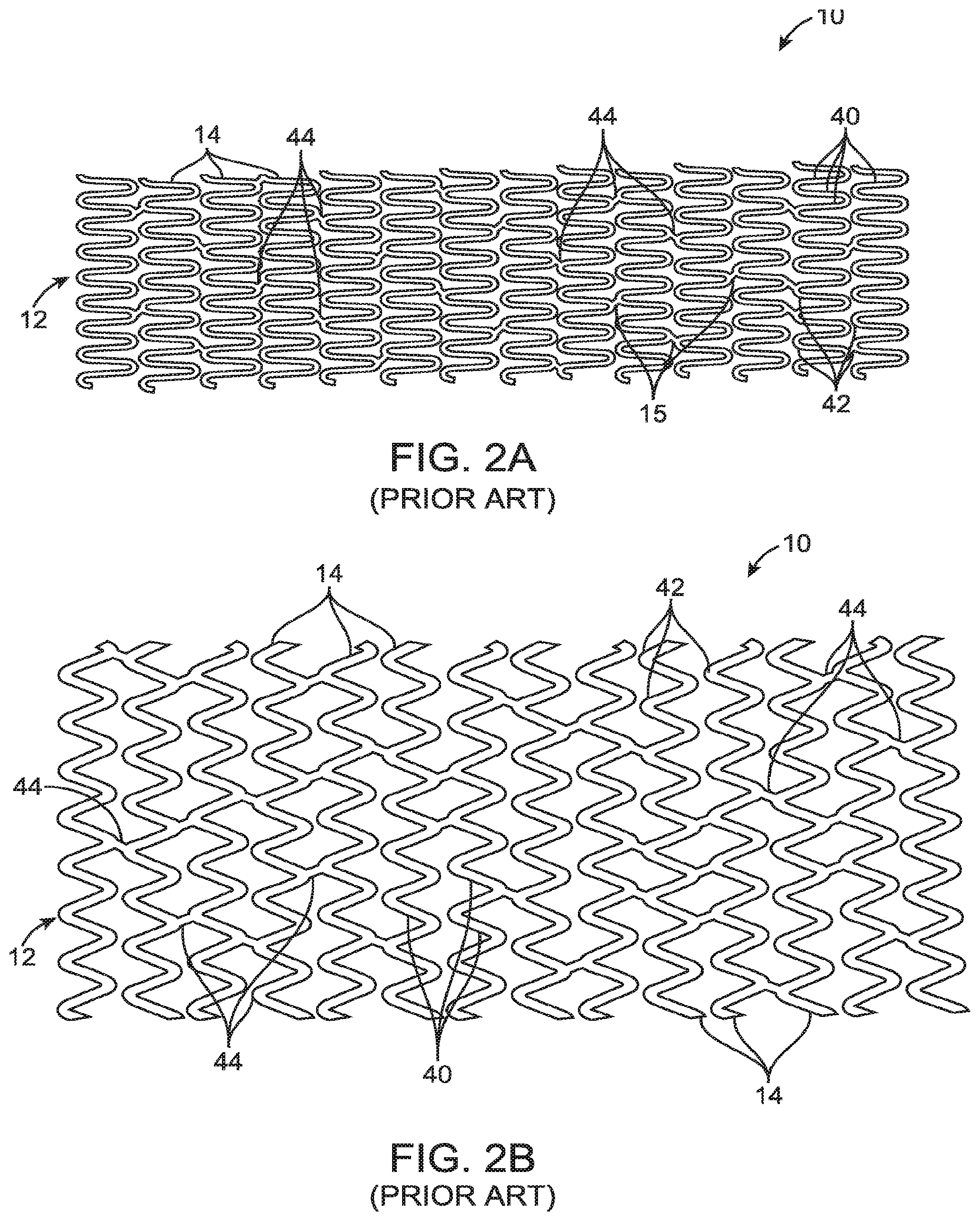 Patent US12599490 Figure 2 – Uncaging stent