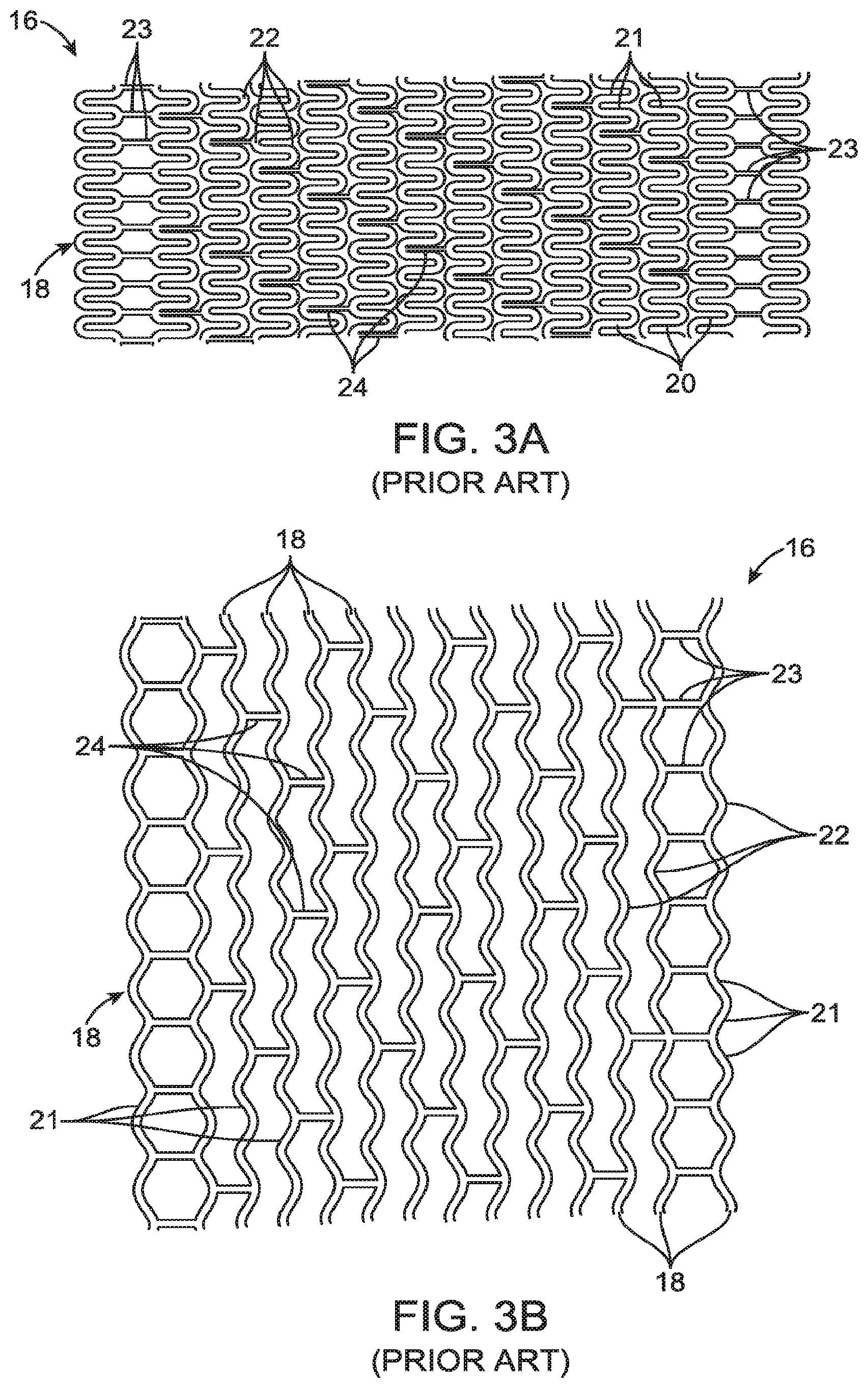 Patent US12599490 Figure 3 – Uncaging stent