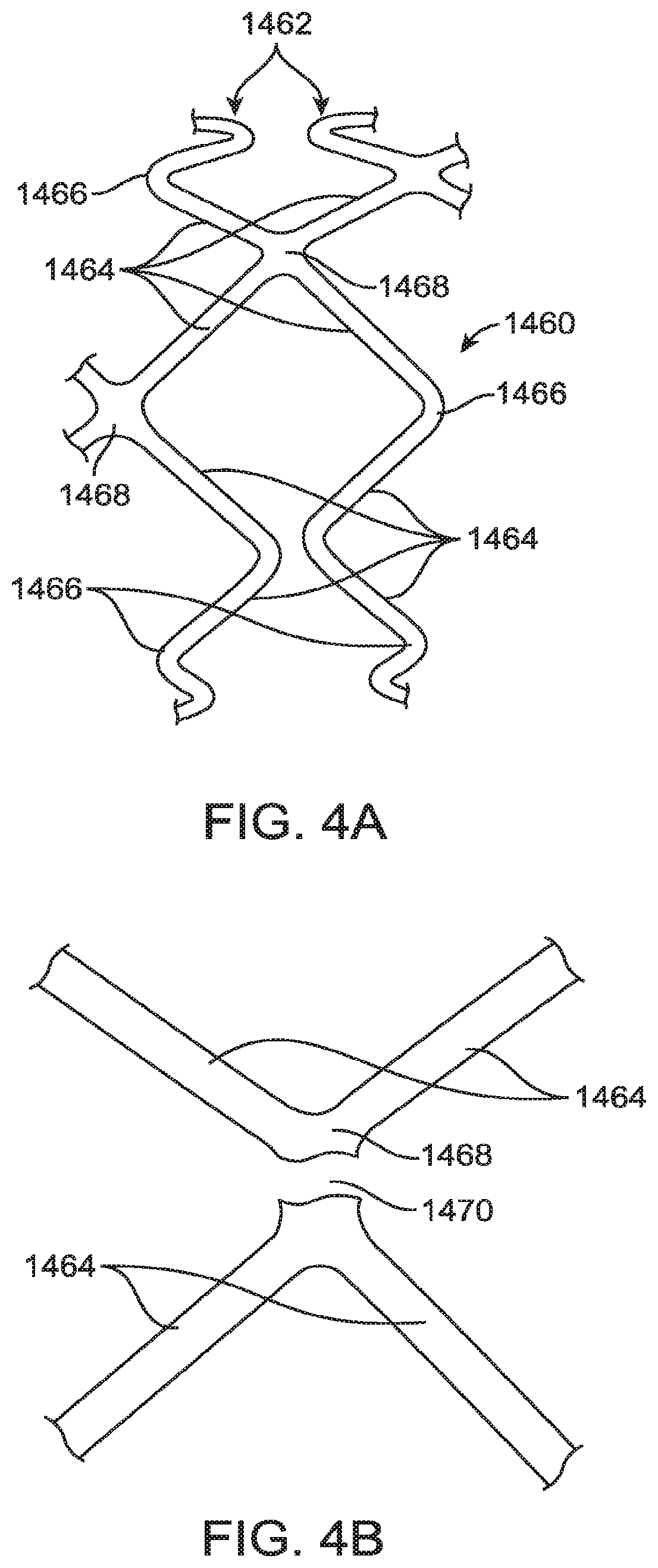 Patent US12599490 Figure 4 – Uncaging stent