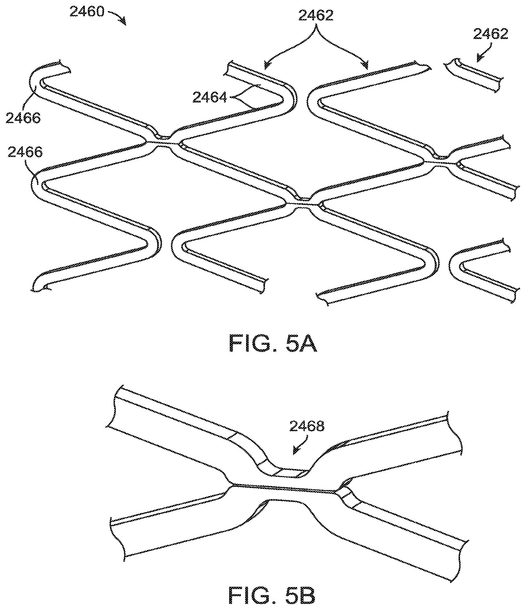 Patent US12599490 Figure 5 – Uncaging stent