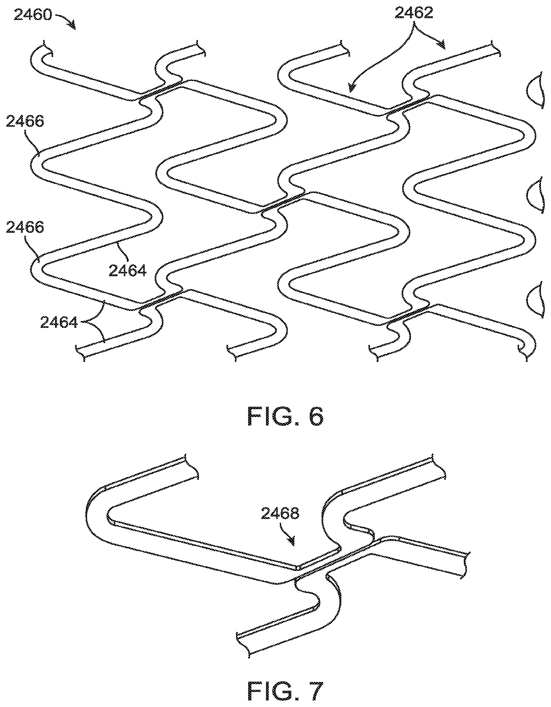 Patent US12599490 Figure 6 – Uncaging stent