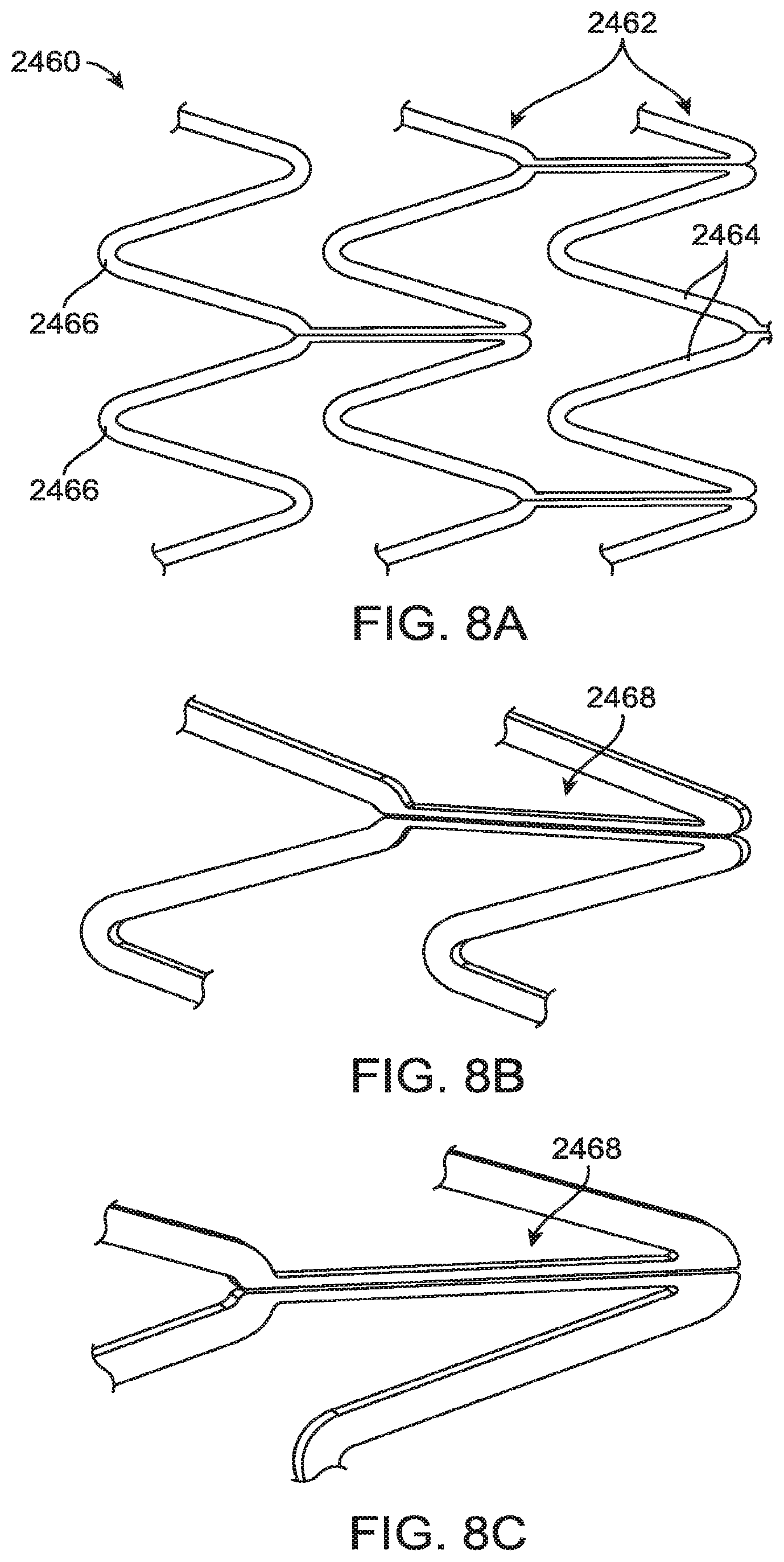 Patent US12599490 Figure 7 – Uncaging stent
