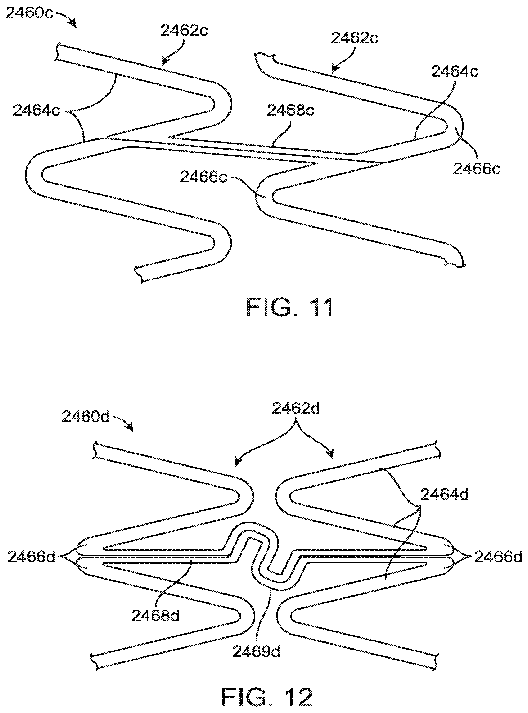 Patent US12599490 Figure 9 – Uncaging stent