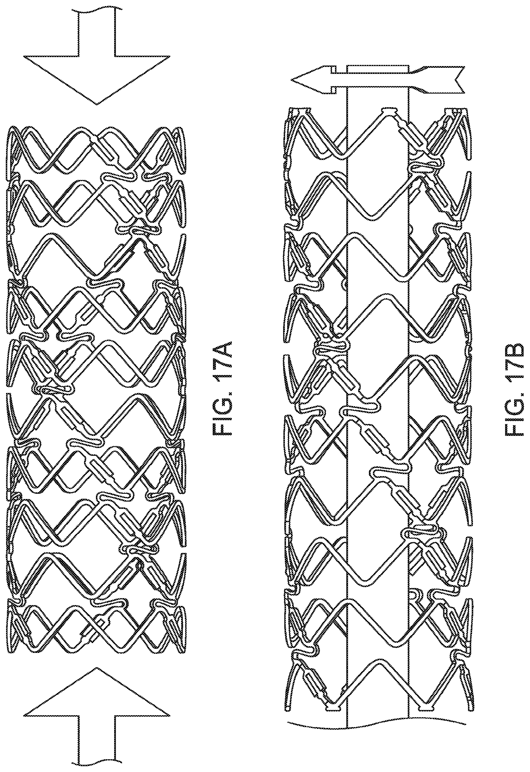 Patent US12599490 Figure 14 – Uncaging stent