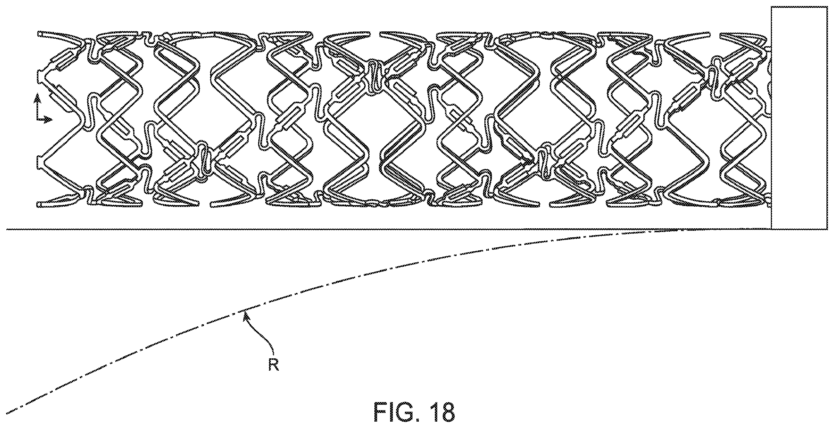 Patent US12599490 Figure 15 – Uncaging stent