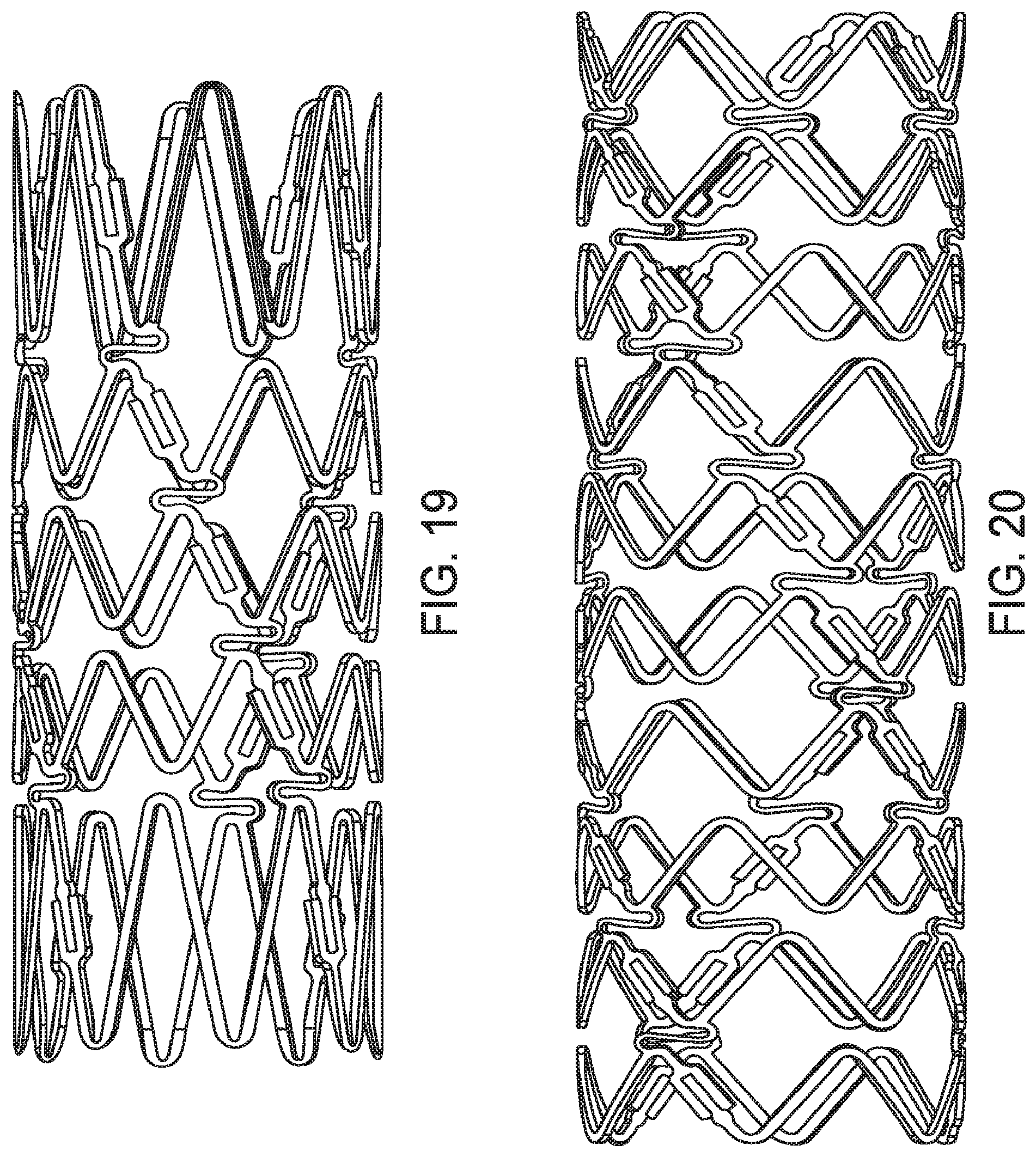 Patent US12599490 Figure 16 – Uncaging stent