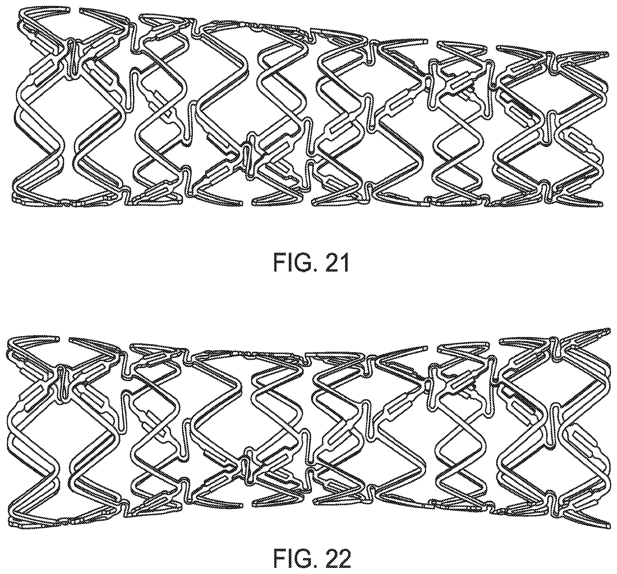 Patent US12599490 Figure 17 – Uncaging stent