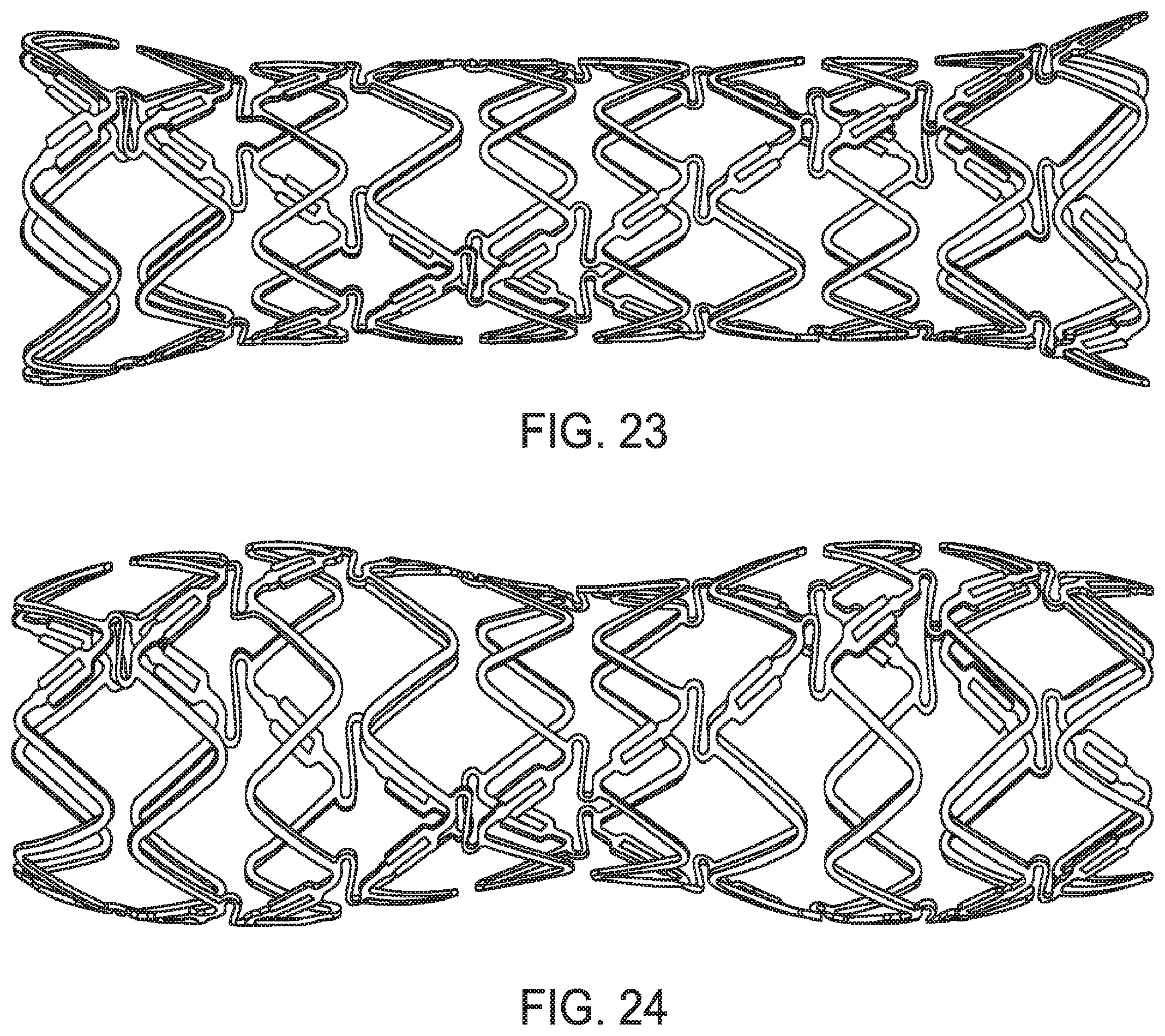Patent US12599490 Figure 18 – Uncaging stent
