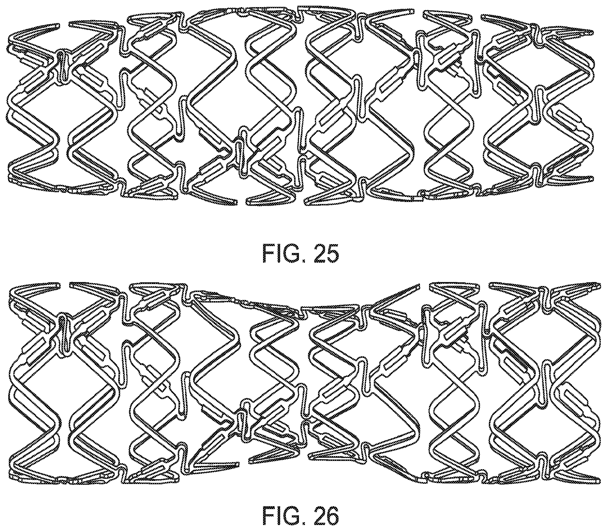 Patent US12599490 Figure 19 – Uncaging stent